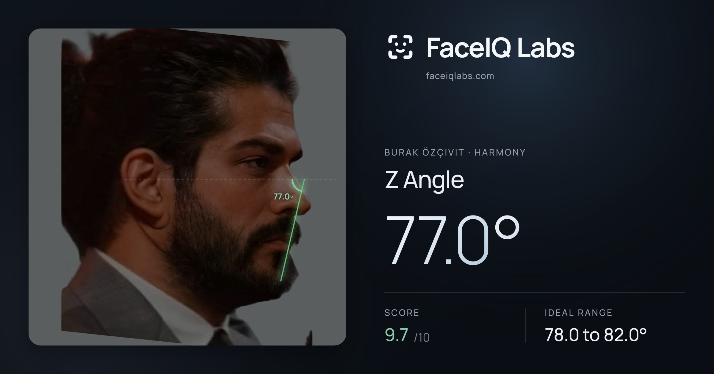 Burak Özçivit Z Angle: 77.0°, drawn on the photo