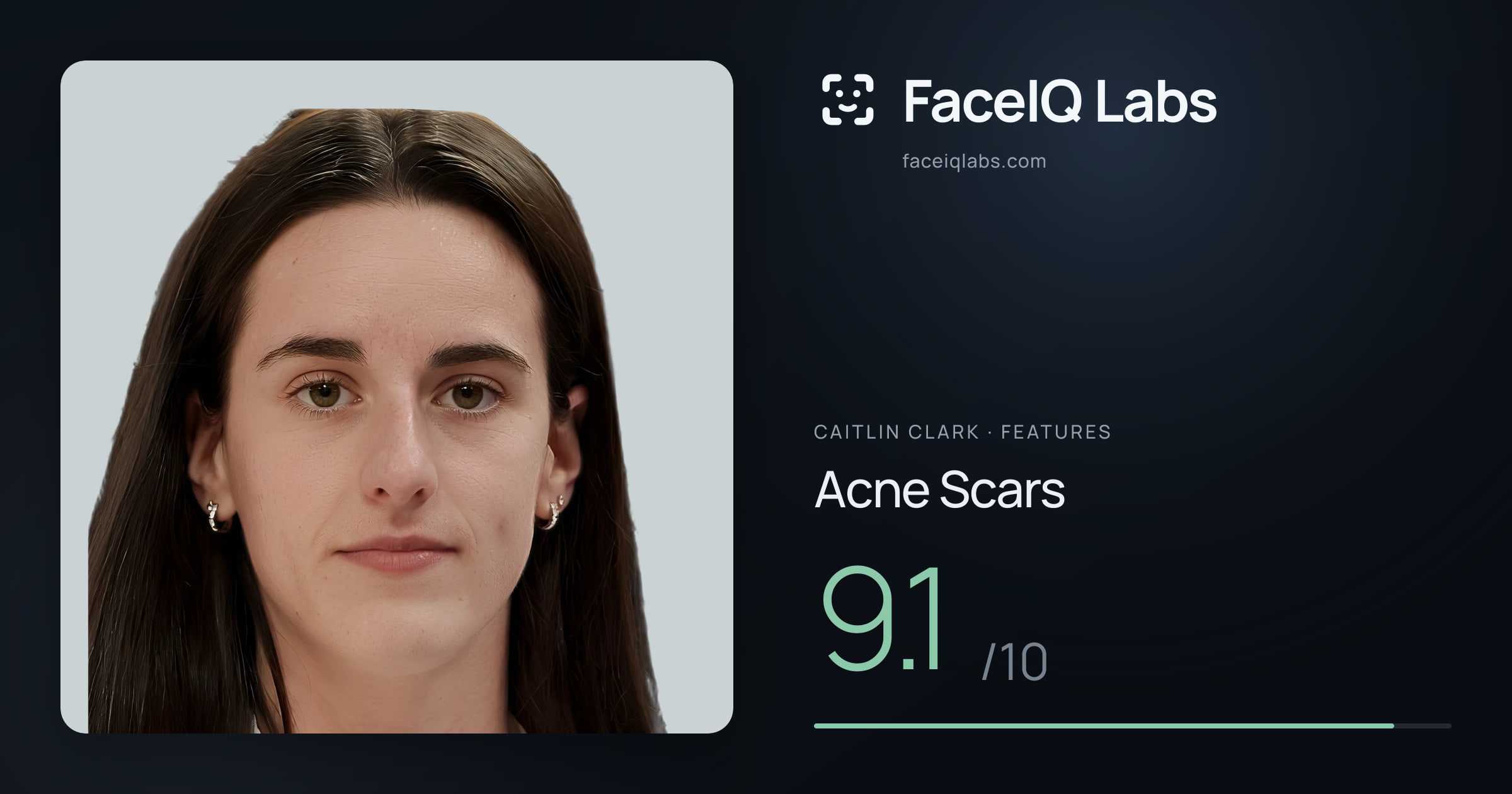 Caitlin Clark Acne Scars: 9.1/10, drawn on the photo