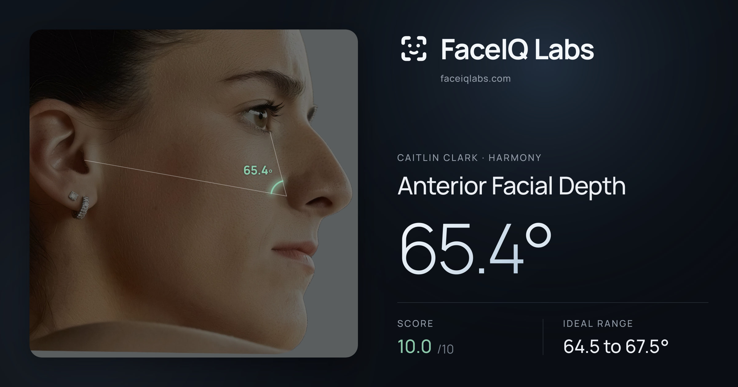 Caitlin Clark Anterior Facial Depth: 65.4°, drawn on the photo