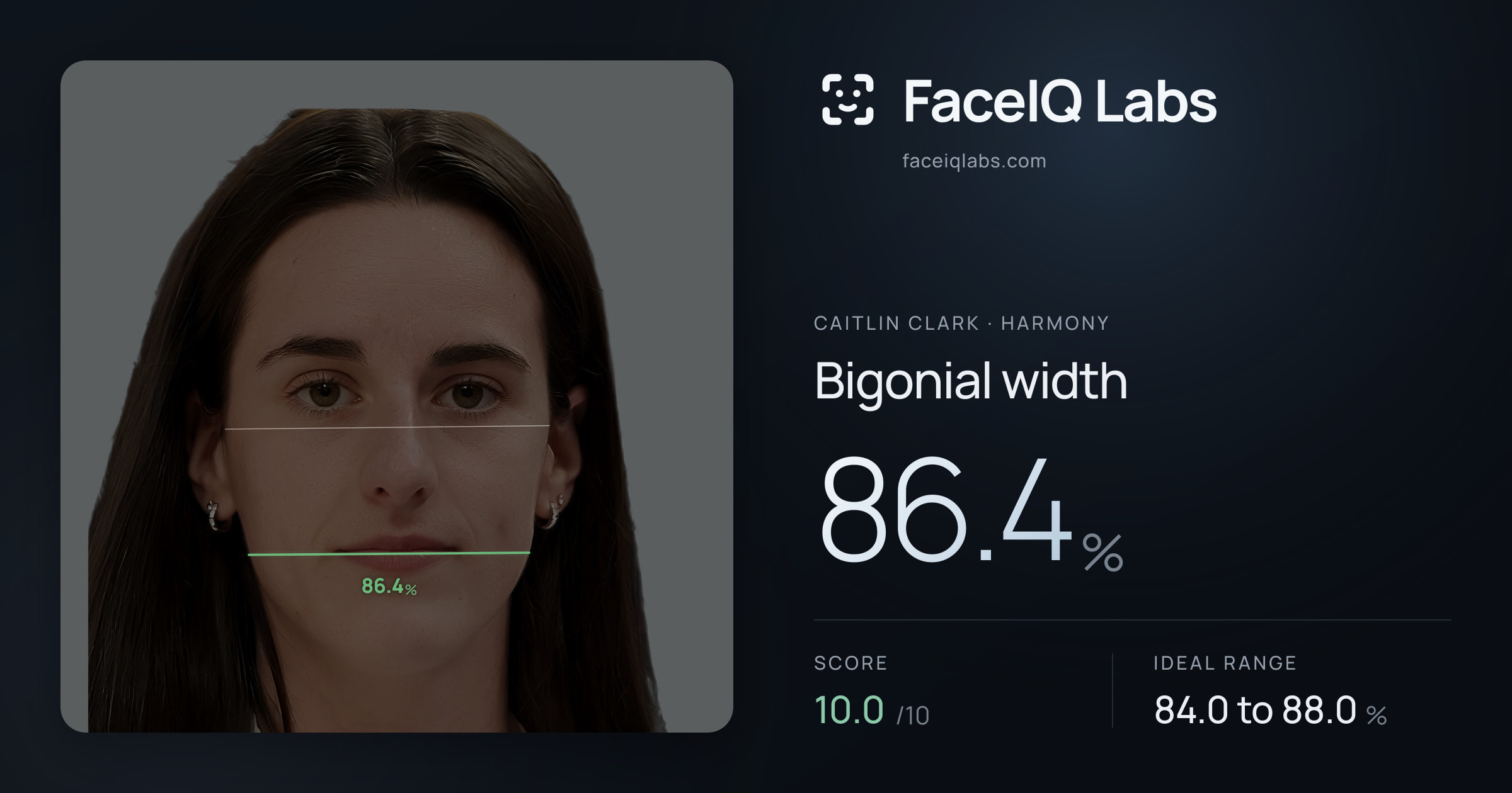 Caitlin Clark Bigonial width: 86.4%, drawn on the photo