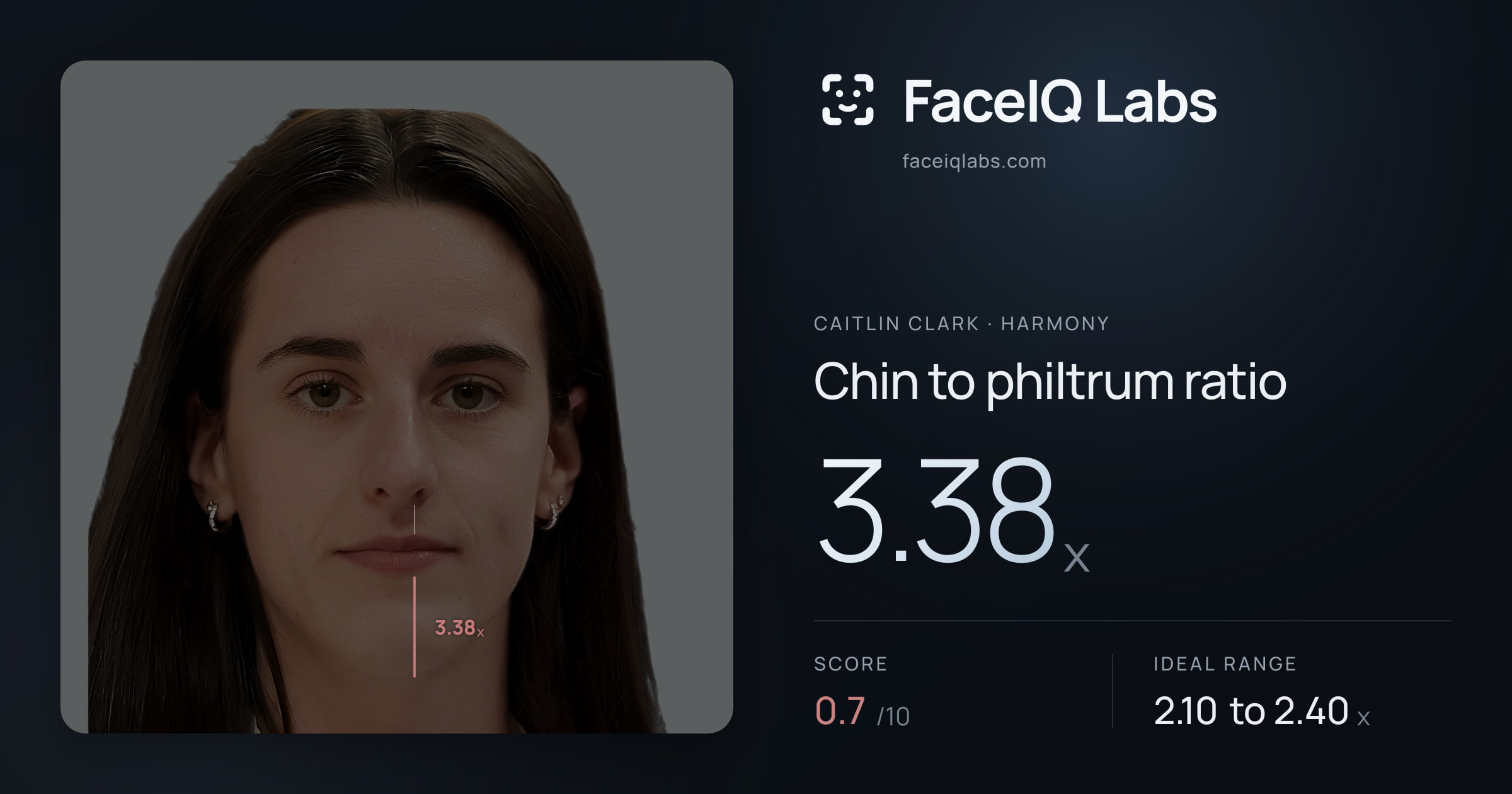 Caitlin Clark Chin to philtrum ratio: 3.38x, drawn on the photo