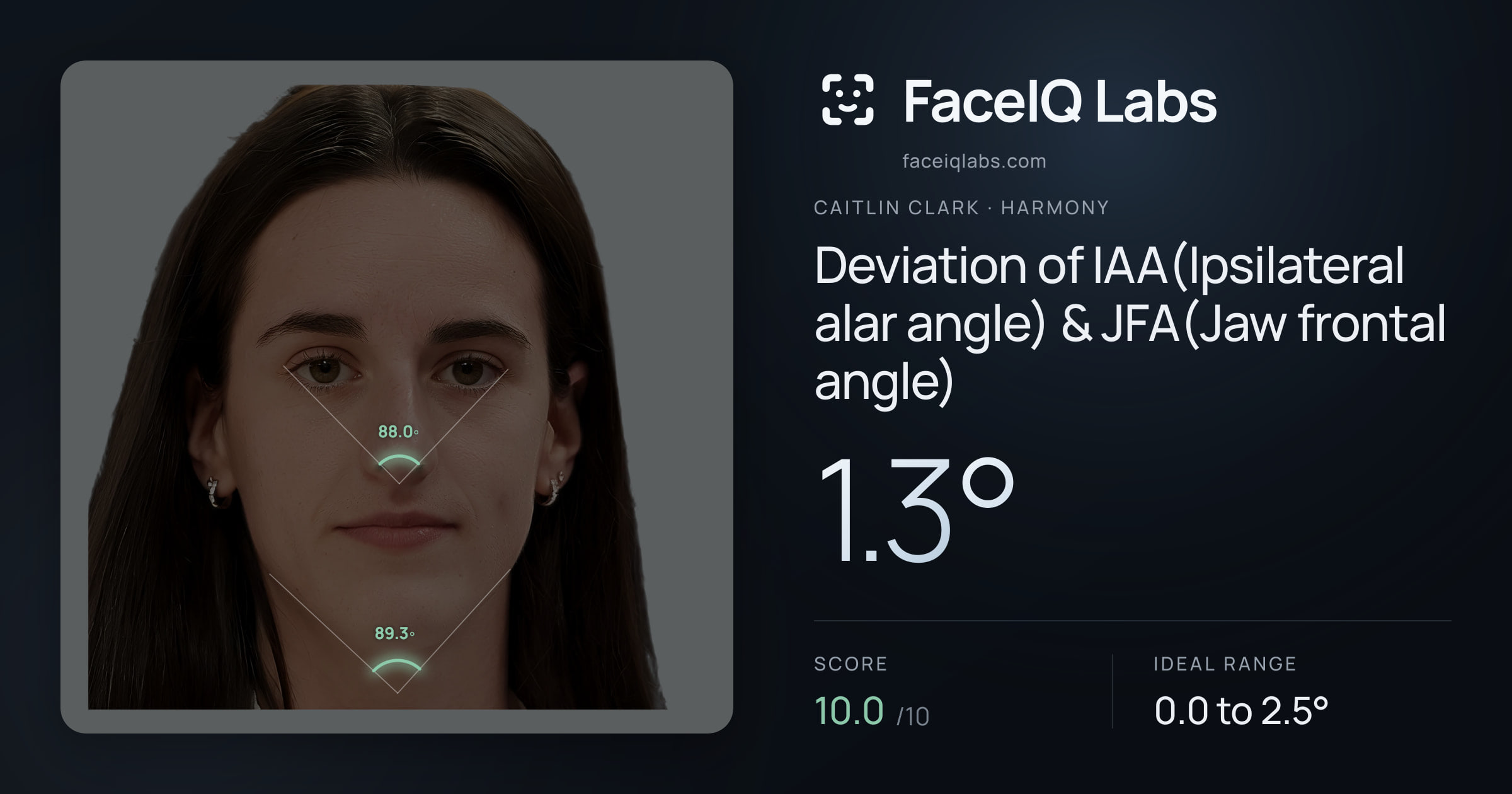 Caitlin Clark Deviation of IAA(Ipsilateral alar angle) & JFA(Jaw frontal angle): 1.3°, drawn on the photo