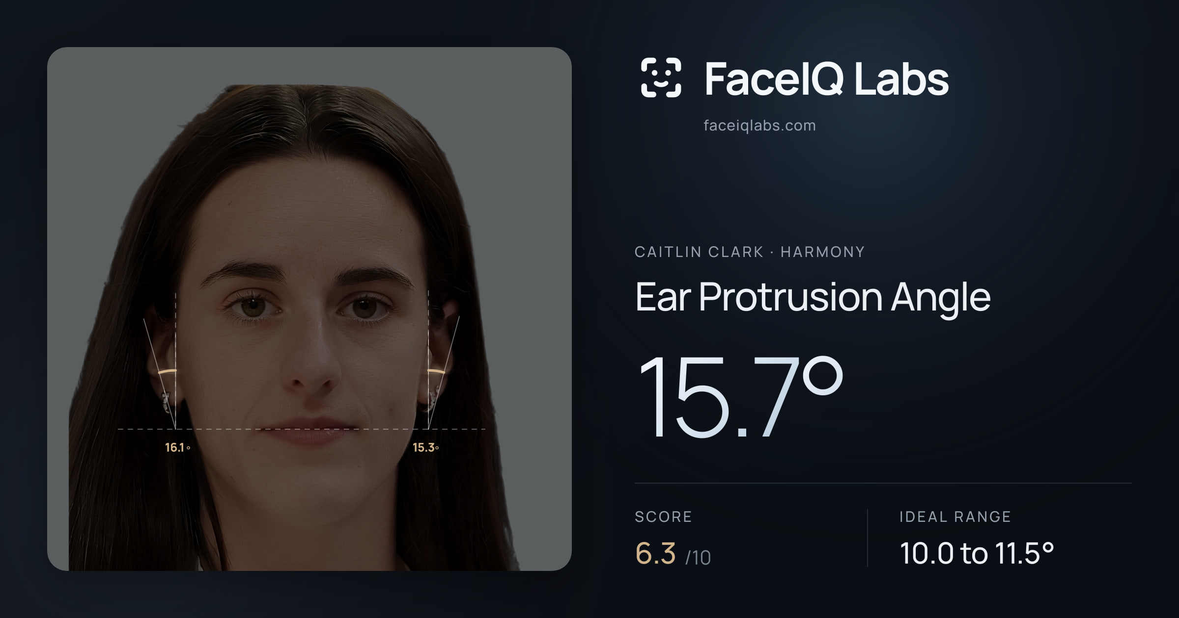 Caitlin Clark Ear Protrusion Angle: 15.7°, drawn on the photo