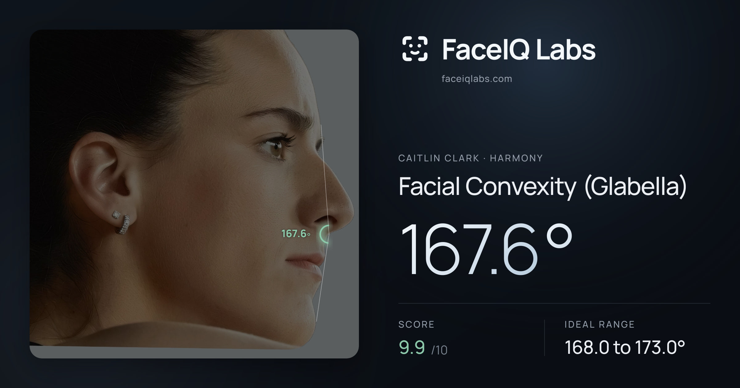 Caitlin Clark Facial Convexity (Glabella): 167.6°, drawn on the photo