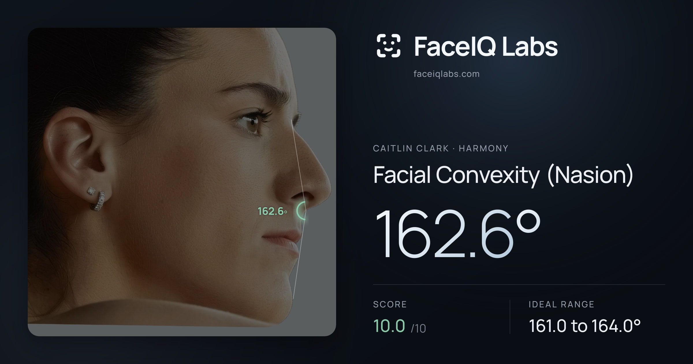 Caitlin Clark Facial Convexity (Nasion): 162.6°, drawn on the photo