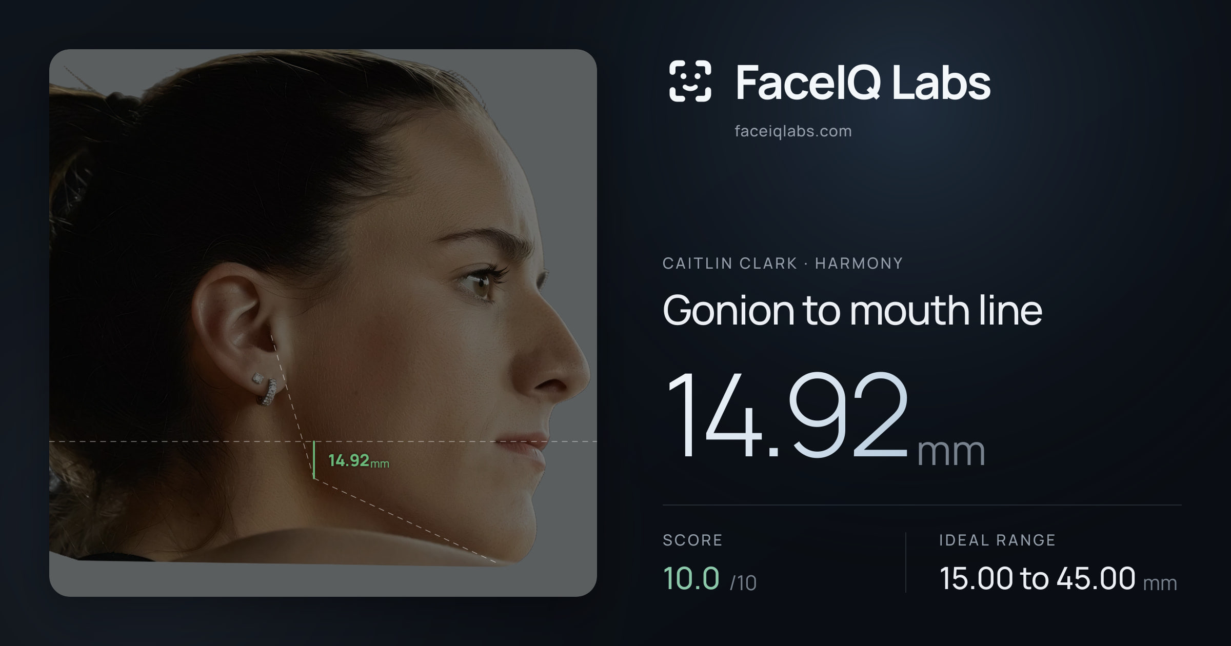 Caitlin Clark Gonion to mouth line: 14.92mm, drawn on the photo