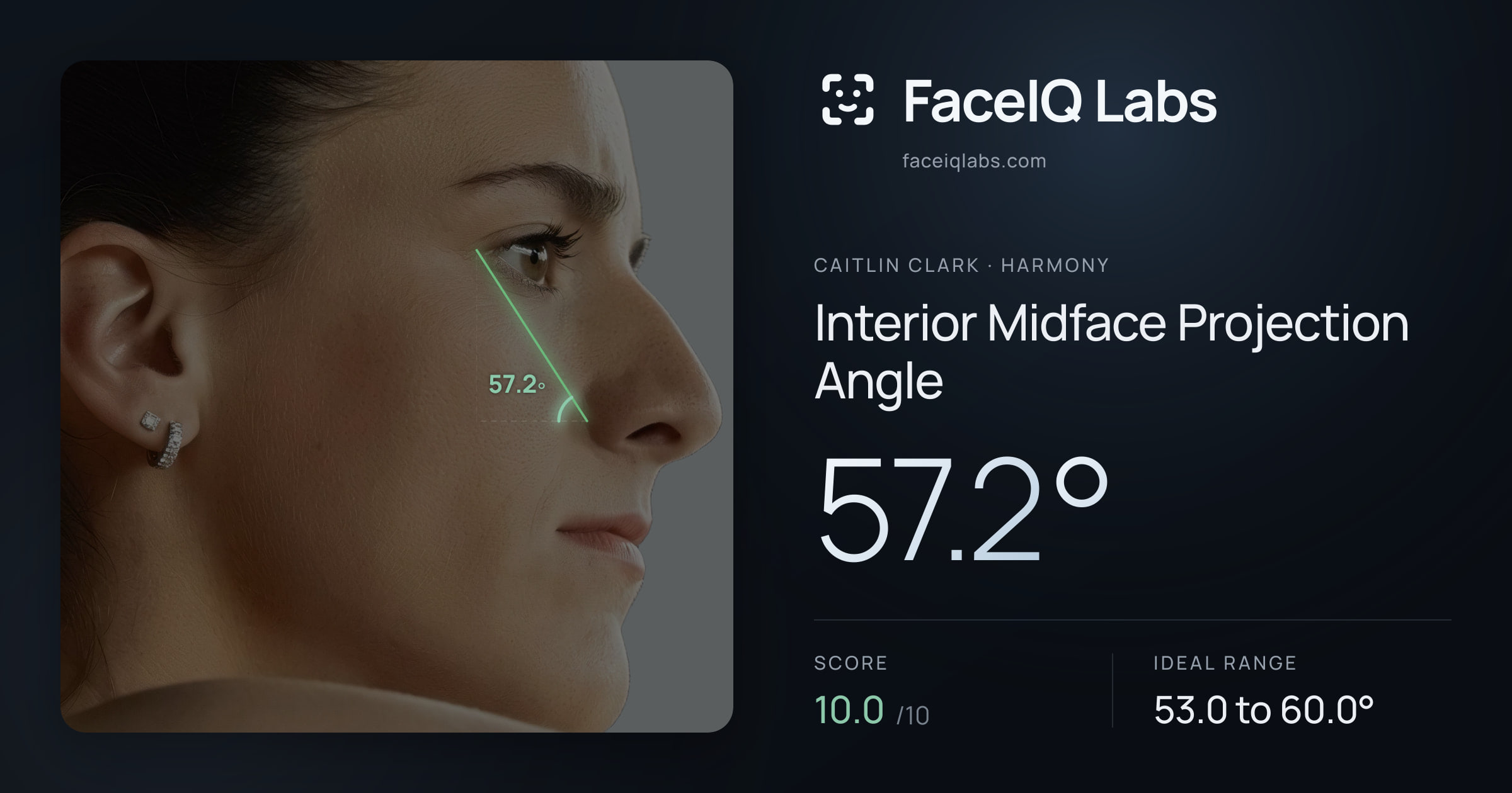 Caitlin Clark Interior Midface Projection Angle: 57.2°, drawn on the photo