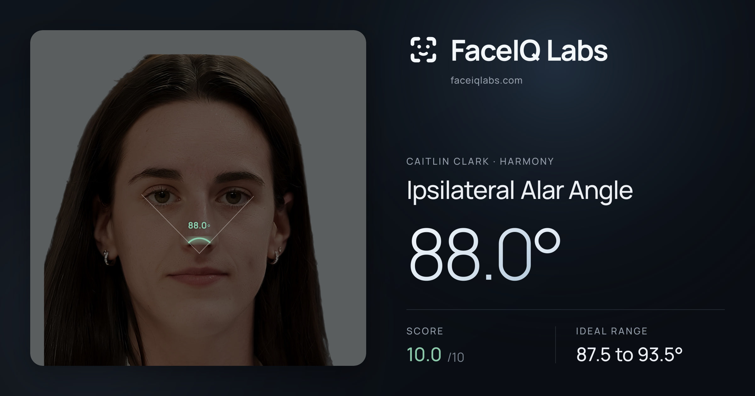 Caitlin Clark Ipsilateral Alar Angle: 88.0°, drawn on the photo