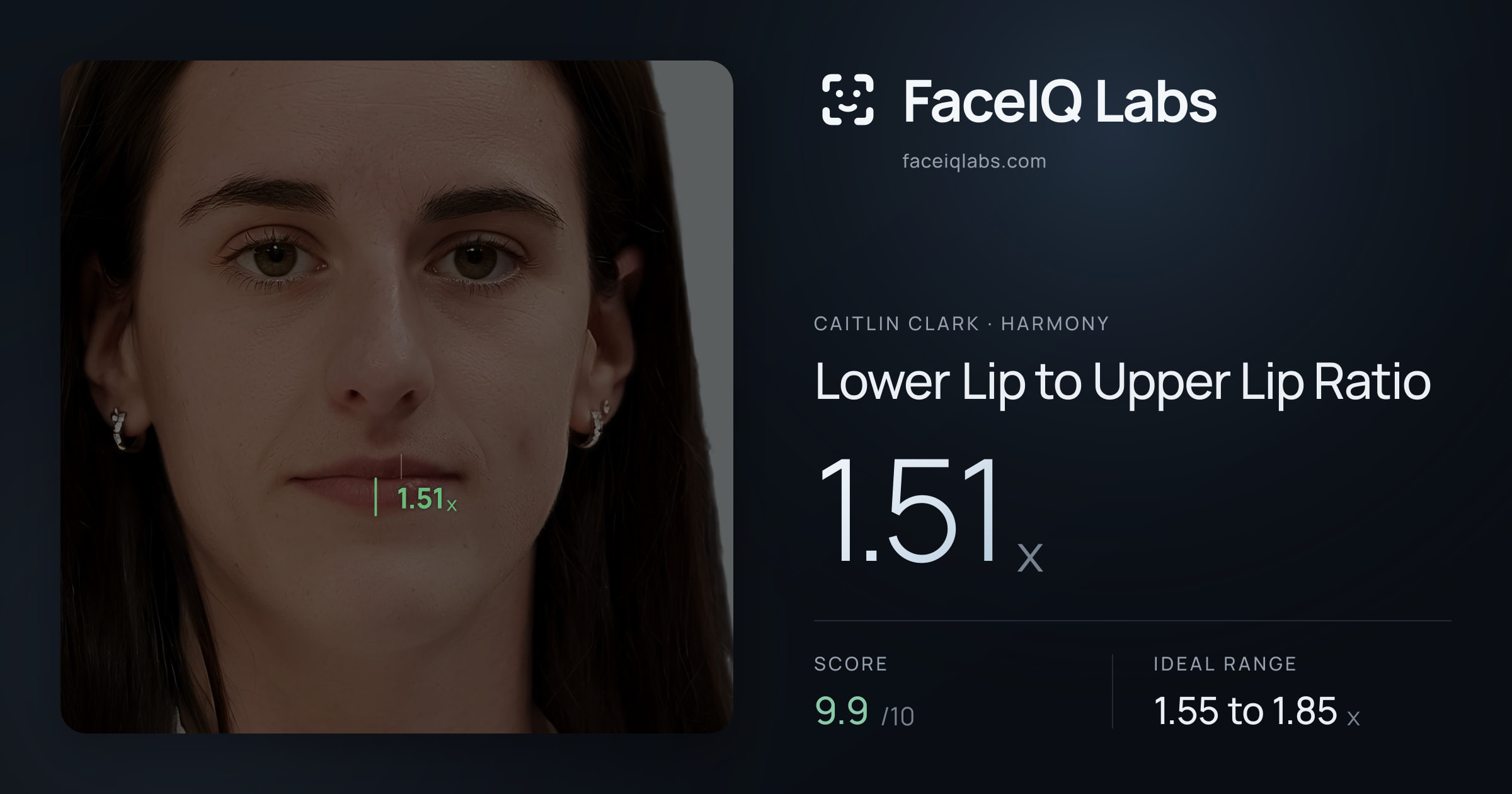 Caitlin Clark Lower Lip to Upper Lip Ratio: 1.51x, drawn on the photo