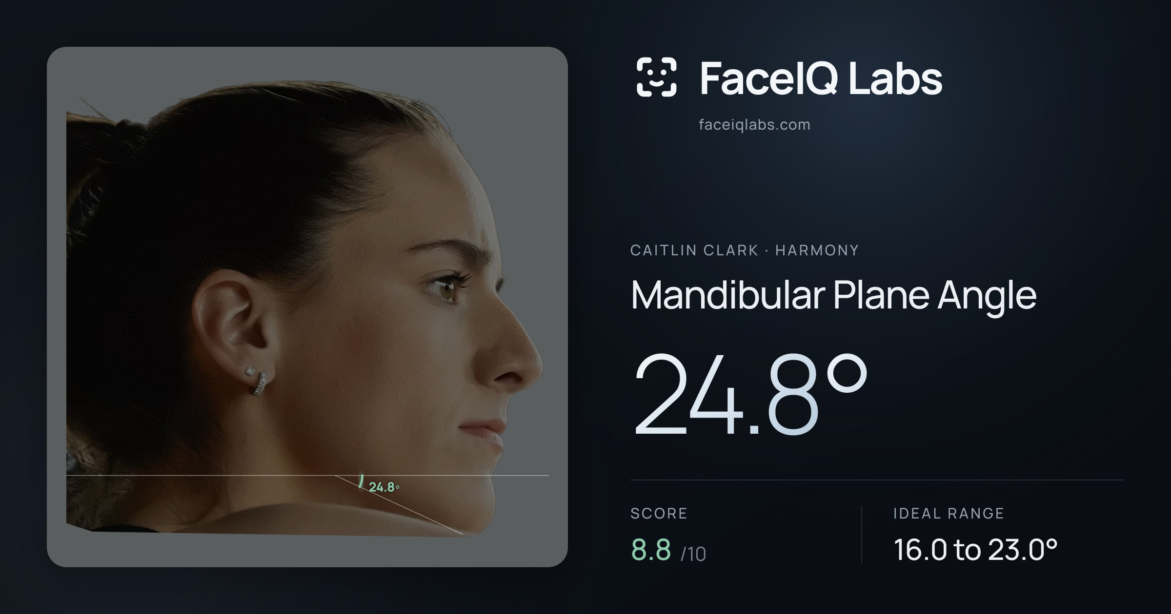Caitlin Clark Mandibular Plane Angle: 24.8°, drawn on the photo