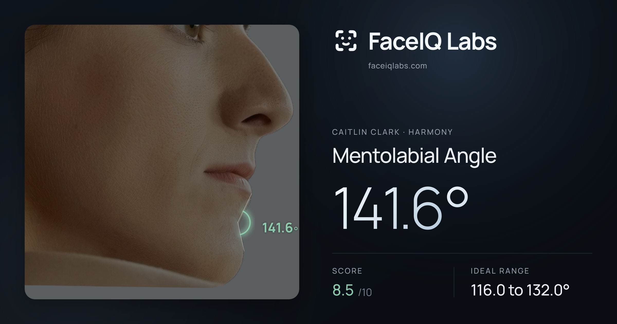 Caitlin Clark Mentolabial Angle: 141.6°, drawn on the photo