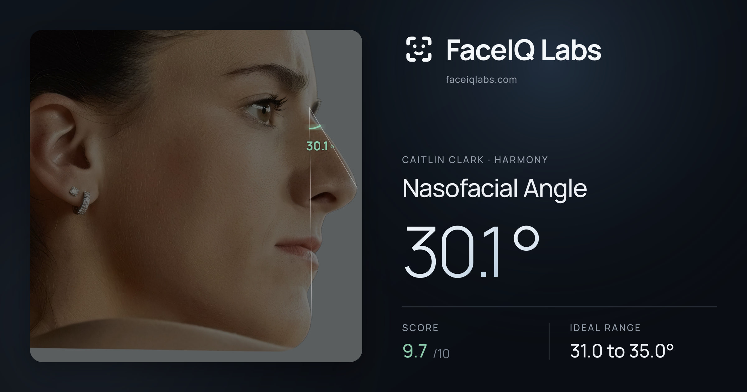 Caitlin Clark Nasofacial Angle: 30.1°, drawn on the photo