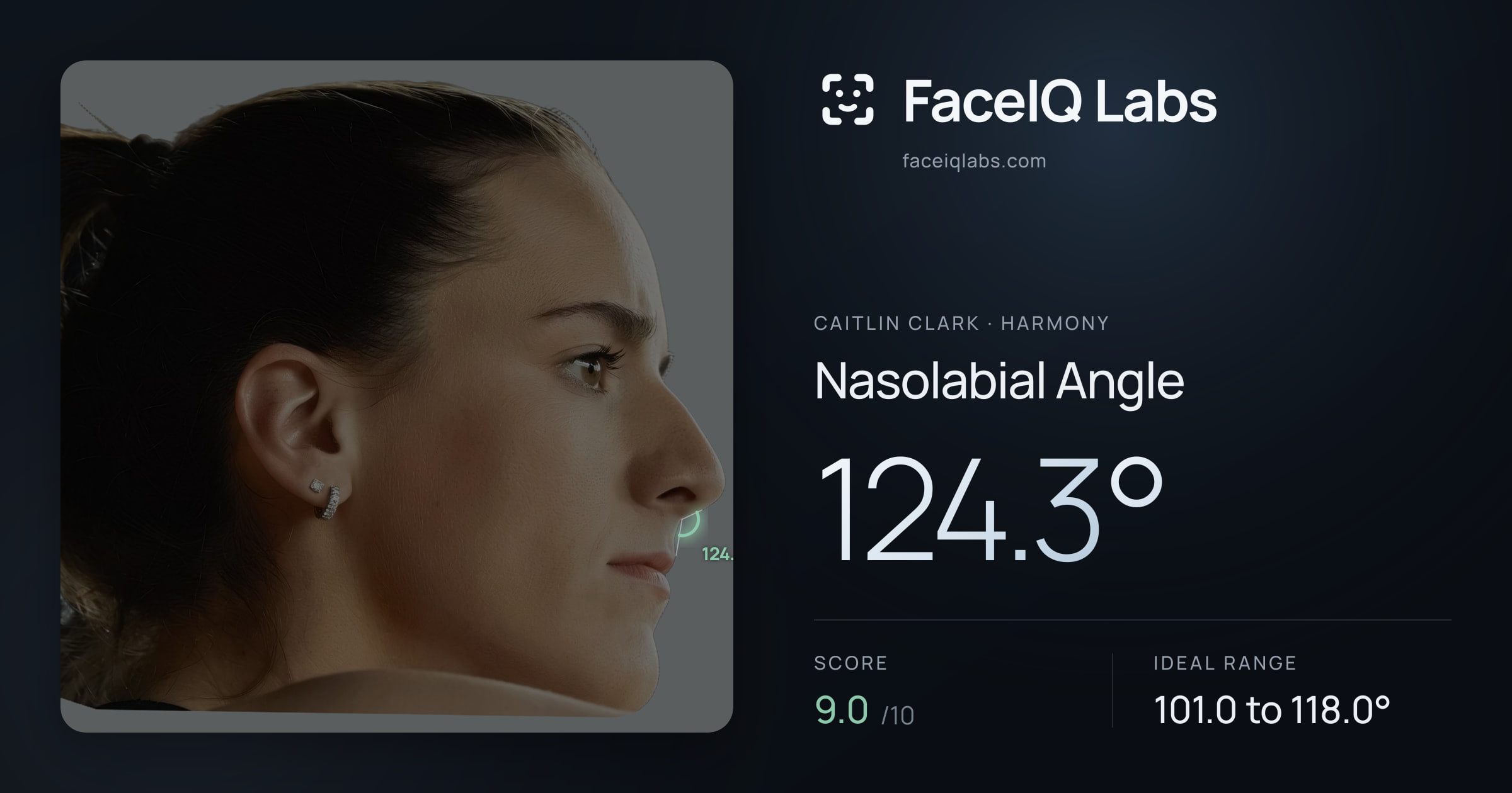 Caitlin Clark Nasolabial Angle: 124.3°, drawn on the photo
