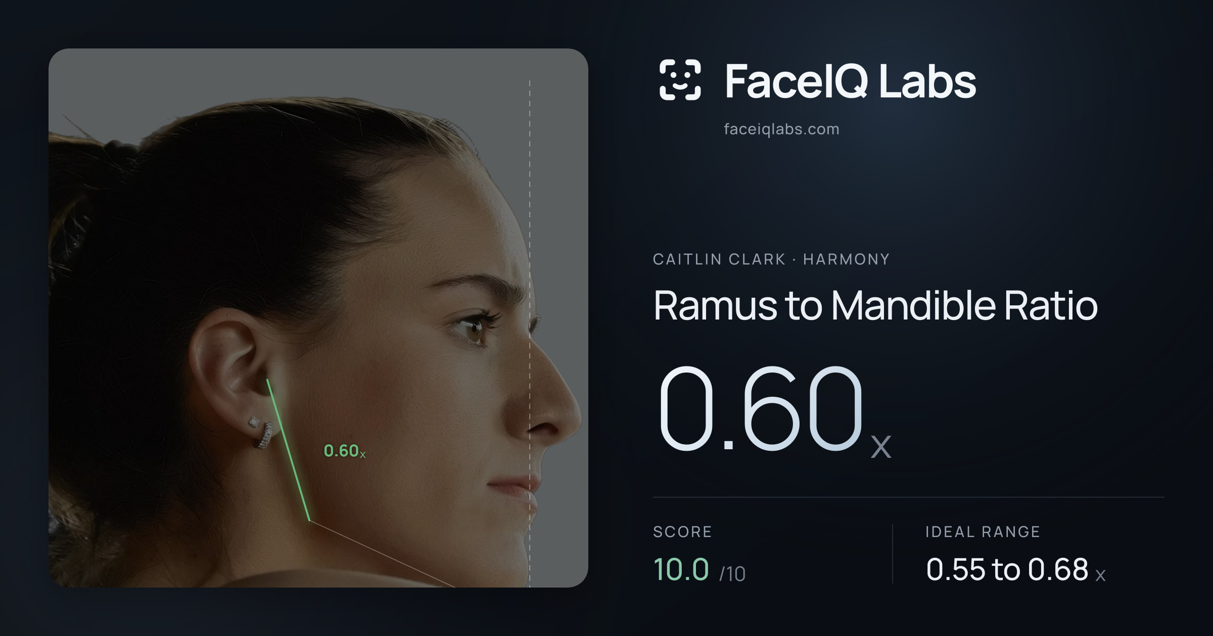 Caitlin Clark Ramus to Mandible Ratio: 0.60x, drawn on the photo