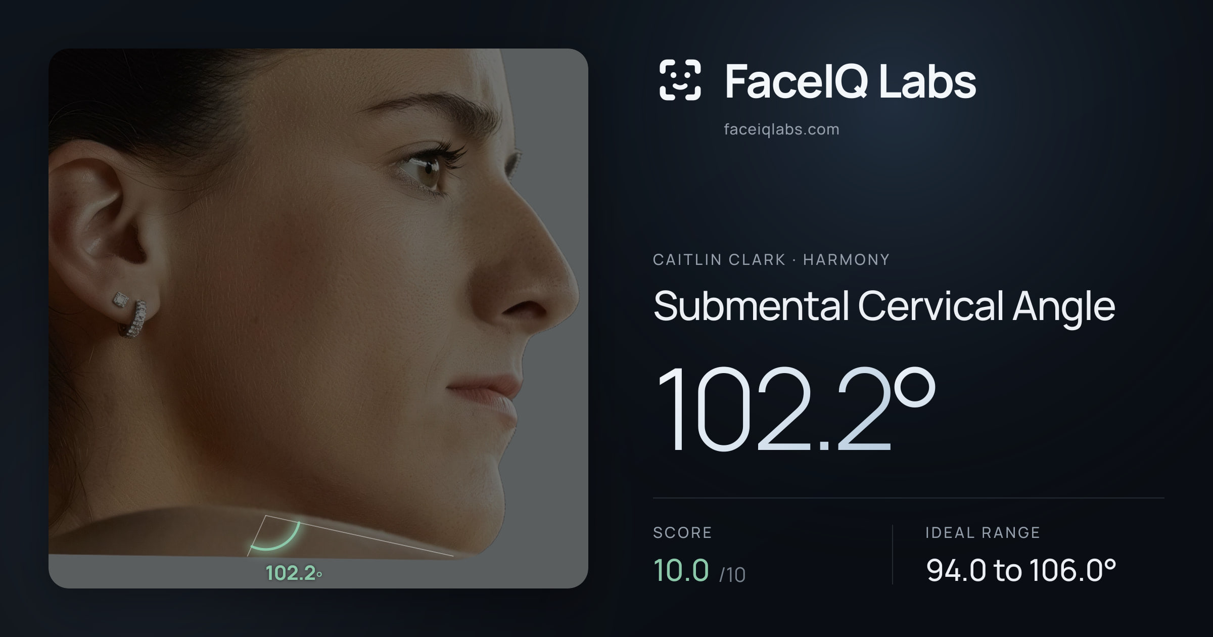 Caitlin Clark Submental Cervical Angle: 102.2°, drawn on the photo