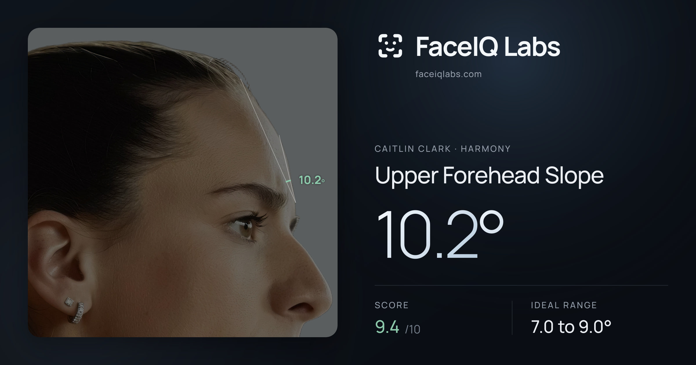Caitlin Clark Upper Forehead Slope: 10.2°, drawn on the photo