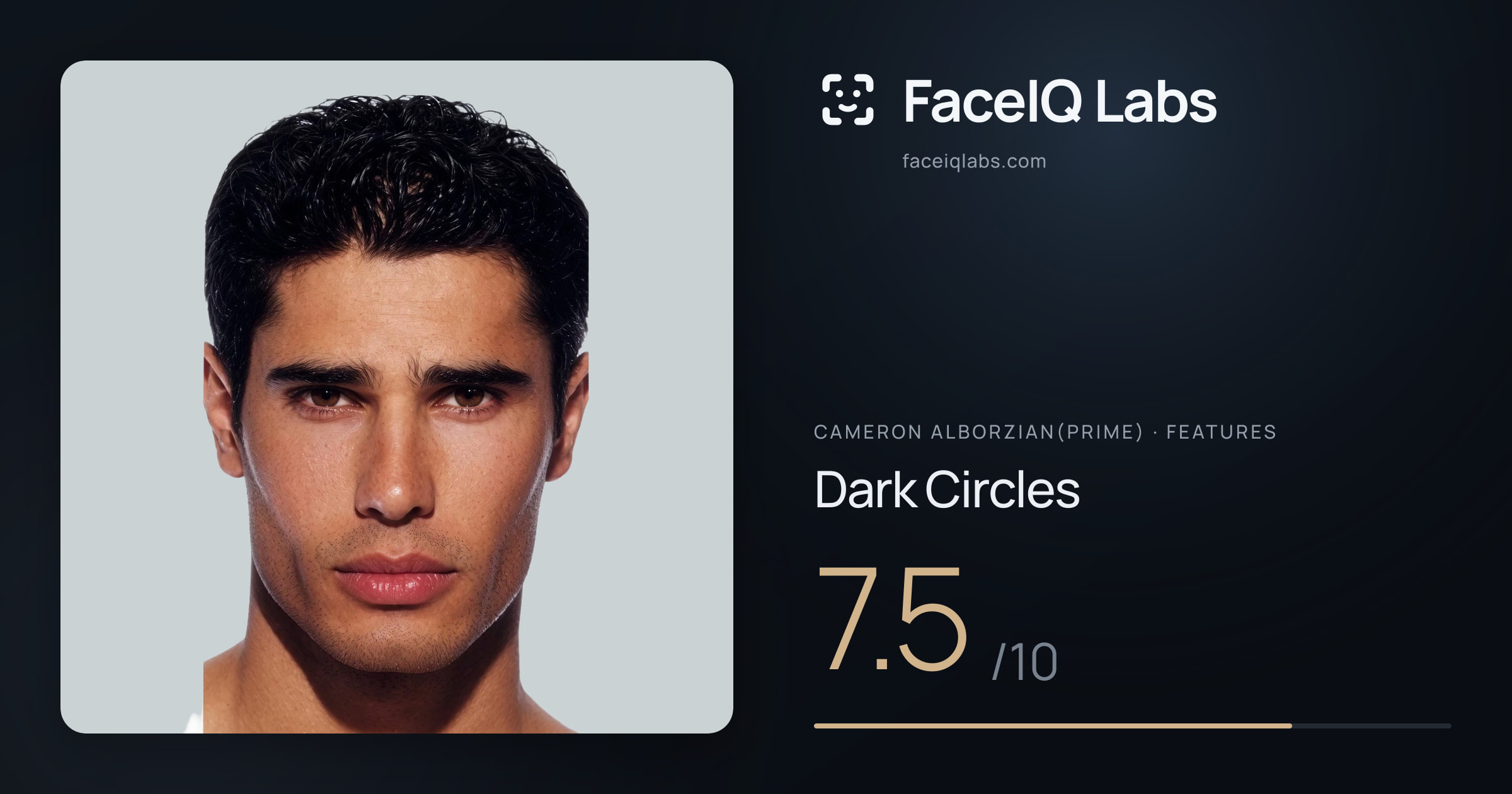Cameron Alborzian(Prime) Dark Circles: 7.5/10, drawn on the photo