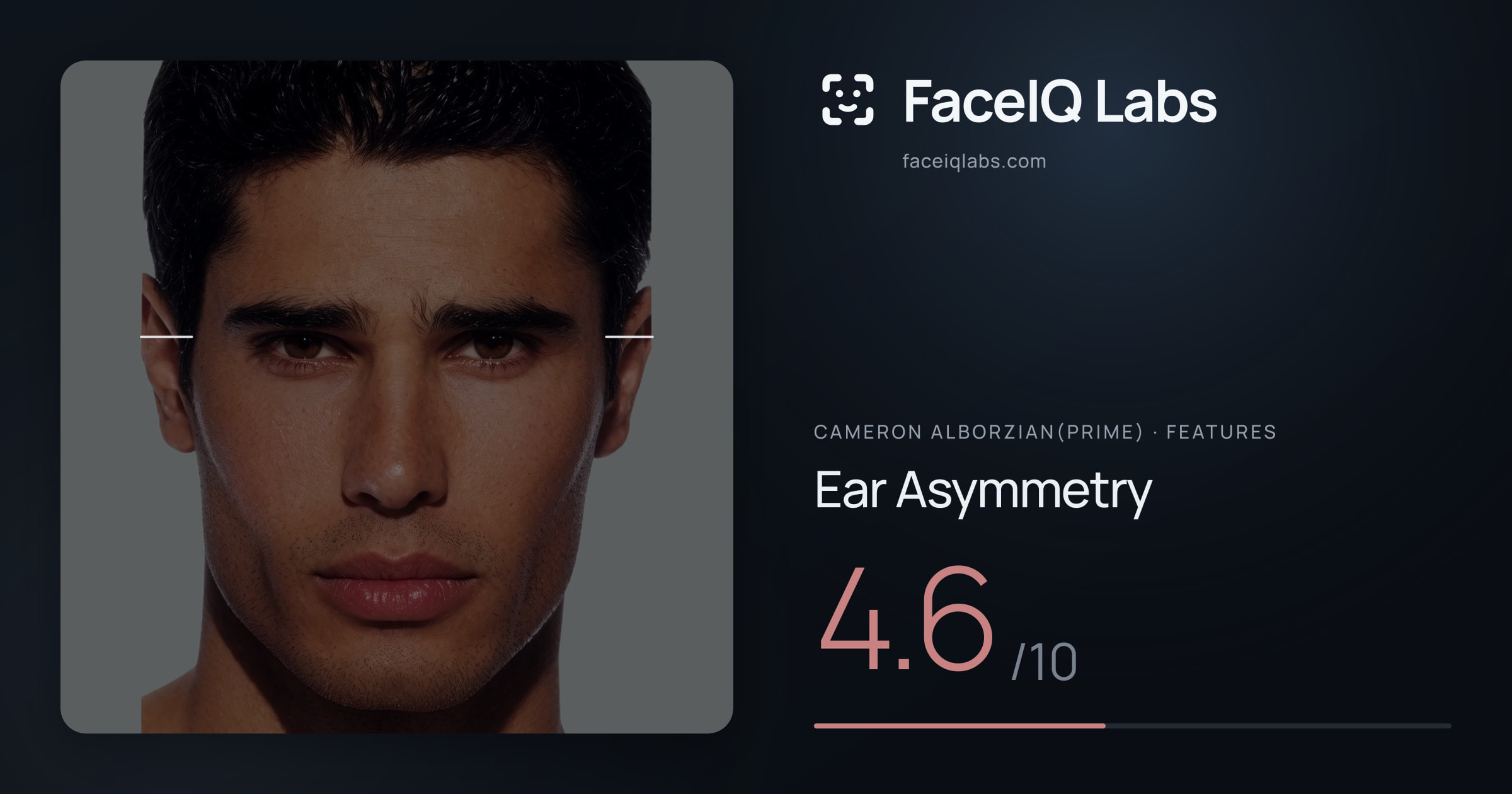 Cameron Alborzian(Prime) Ear Asymmetry: 4.6/10, drawn on the photo