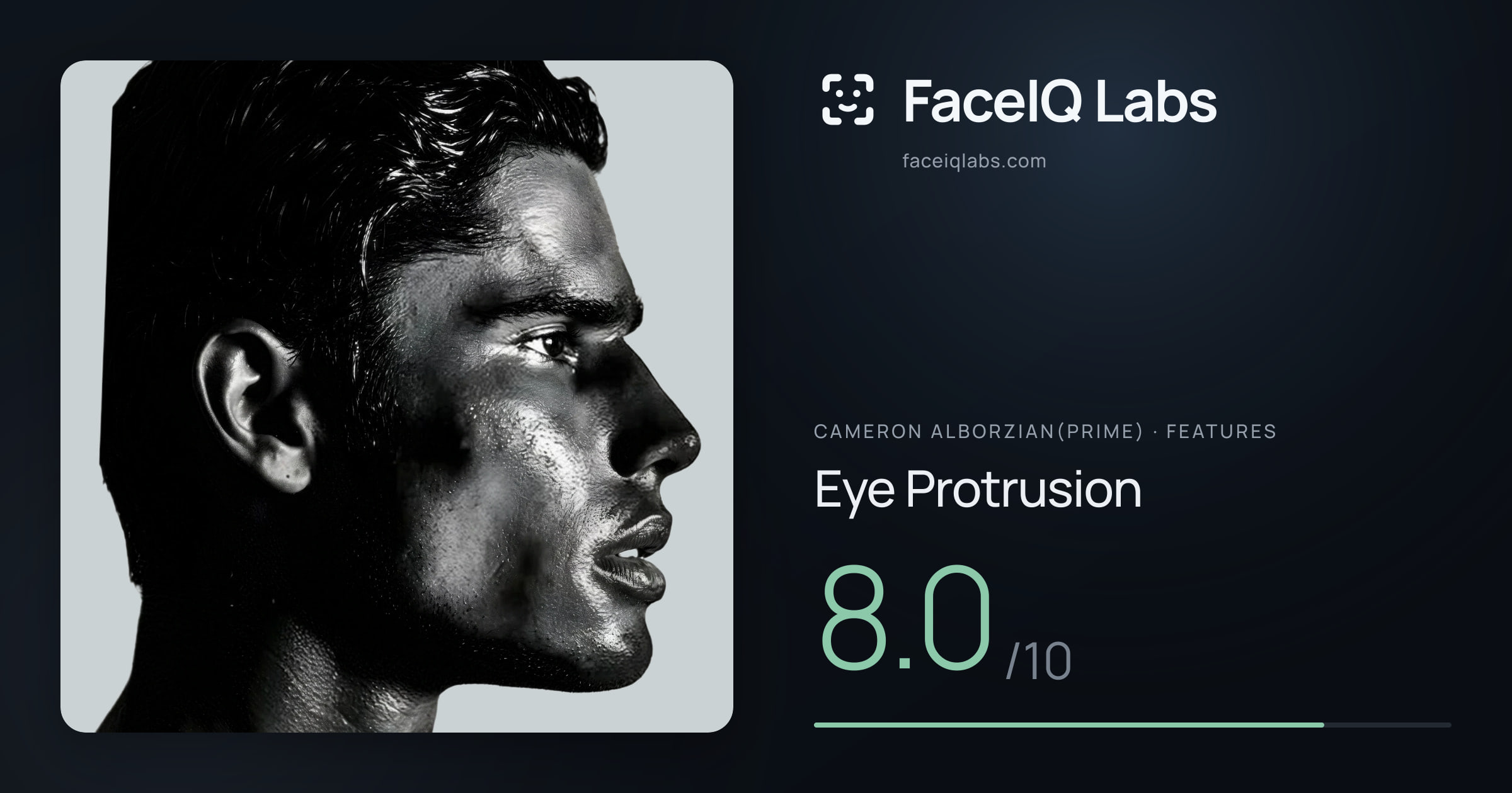 Cameron Alborzian(Prime) Eye Protrusion: 8.0/10, drawn on the photo
