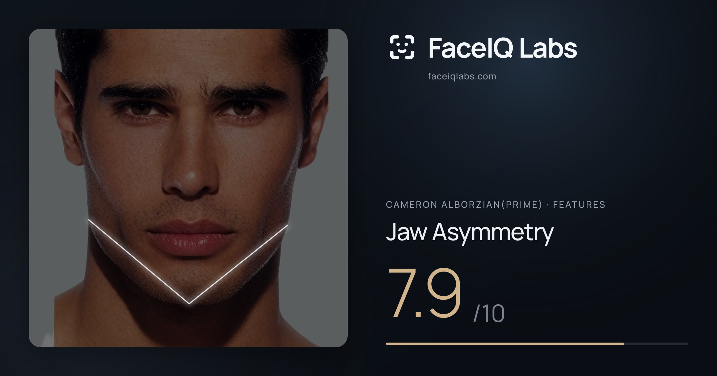 Cameron Alborzian(Prime) Jaw Asymmetry: 7.9/10, drawn on the photo