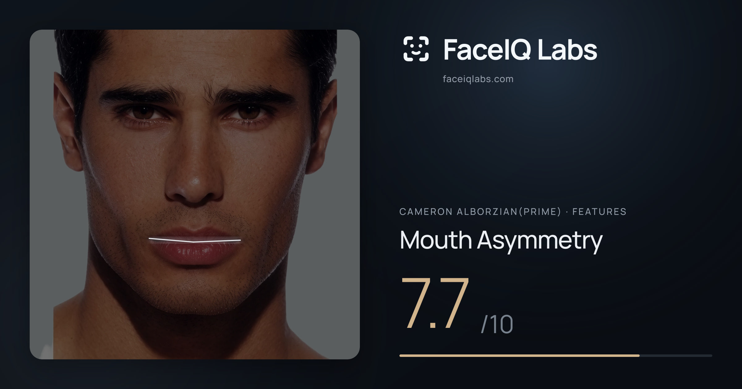 Cameron Alborzian(Prime) Mouth Asymmetry: 7.7/10, drawn on the photo