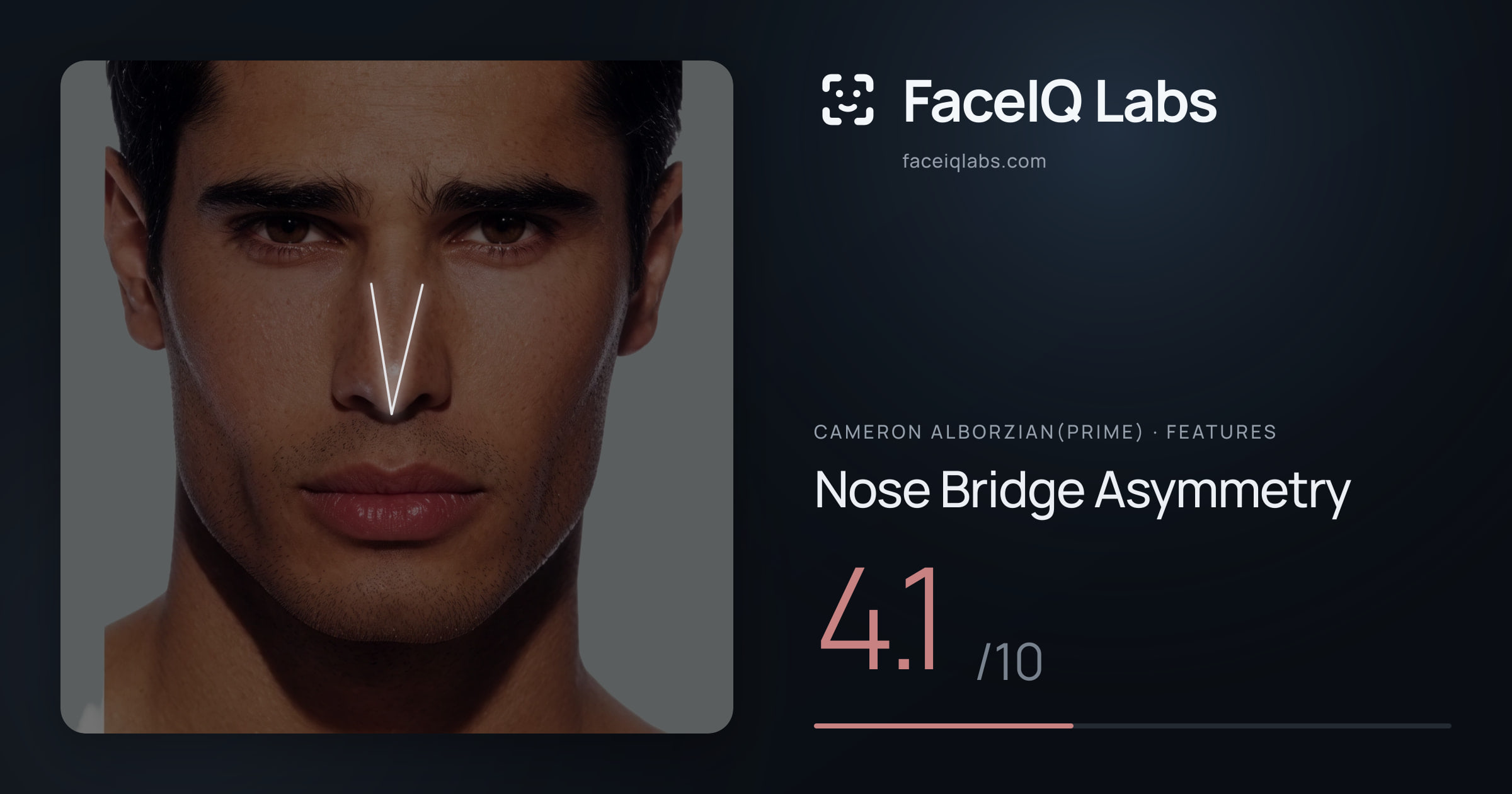 Cameron Alborzian(Prime) Nose Bridge Asymmetry: 4.1/10, drawn on the photo