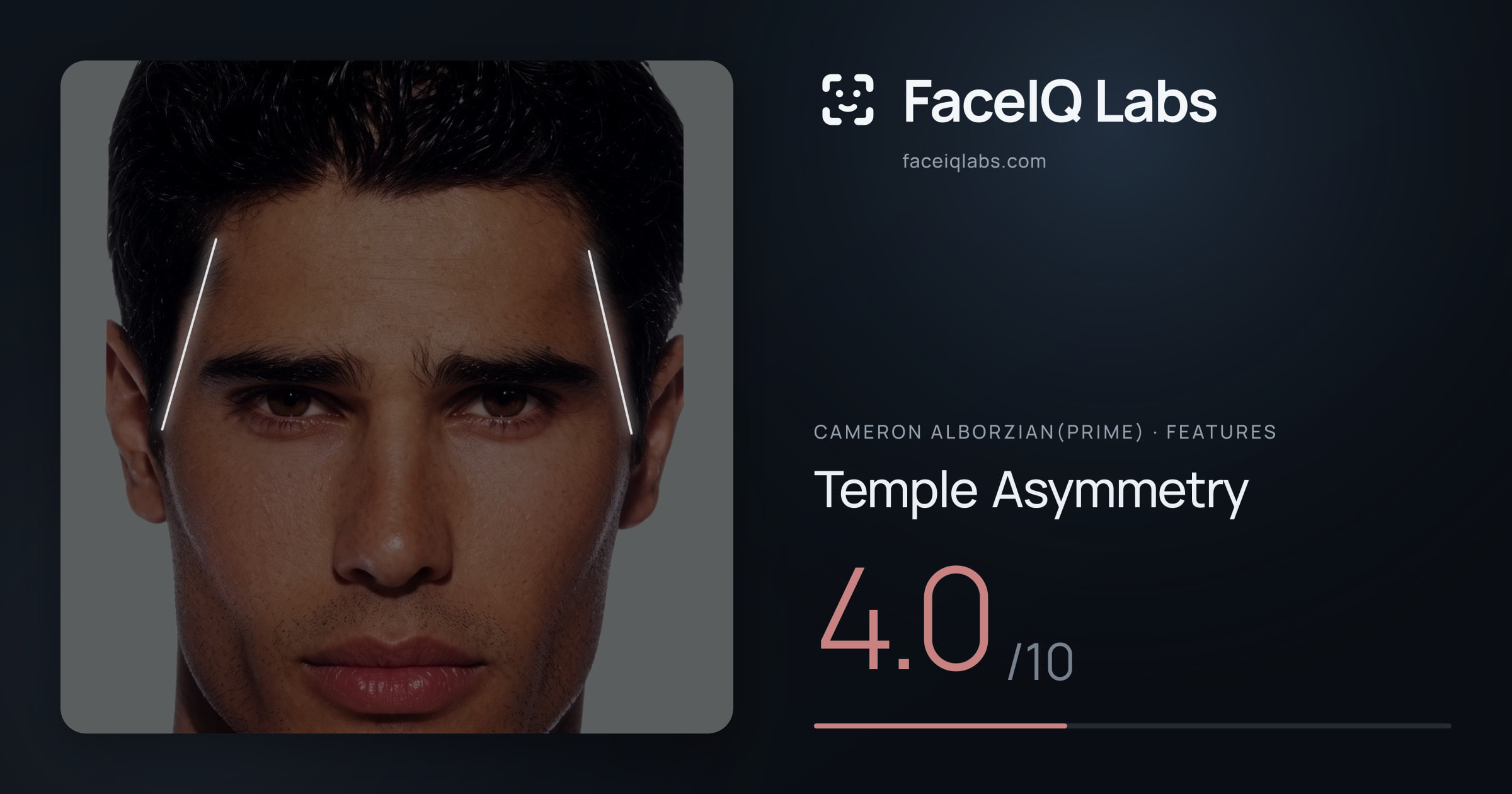 Cameron Alborzian(Prime) Temple Asymmetry: 4.0/10, drawn on the photo