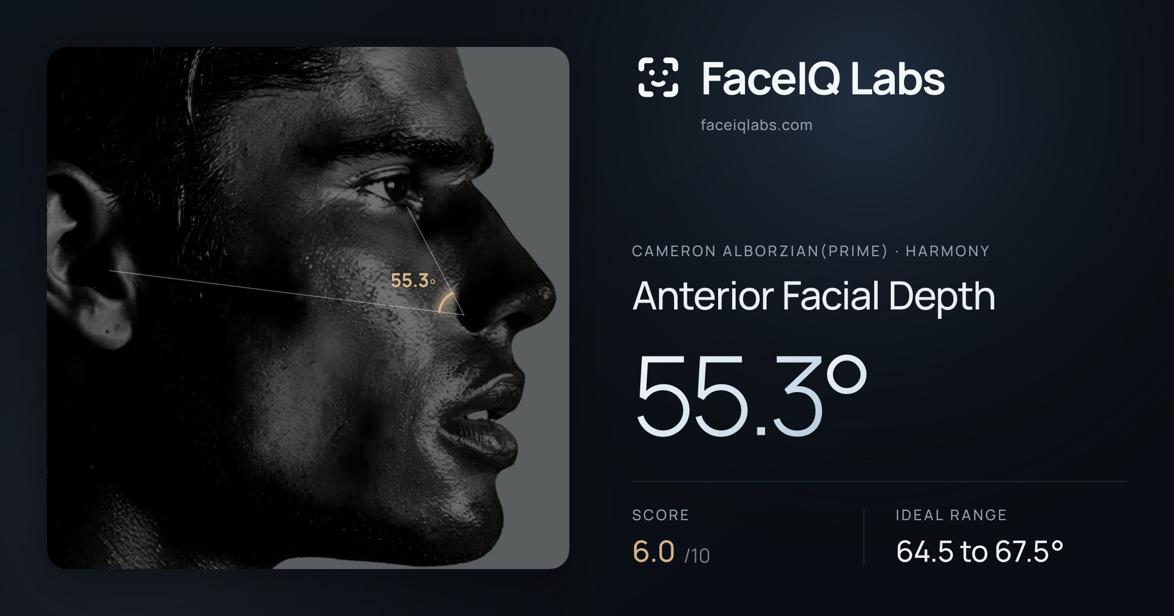 Cameron Alborzian(Prime) Anterior Facial Depth: 55.3°, drawn on the photo