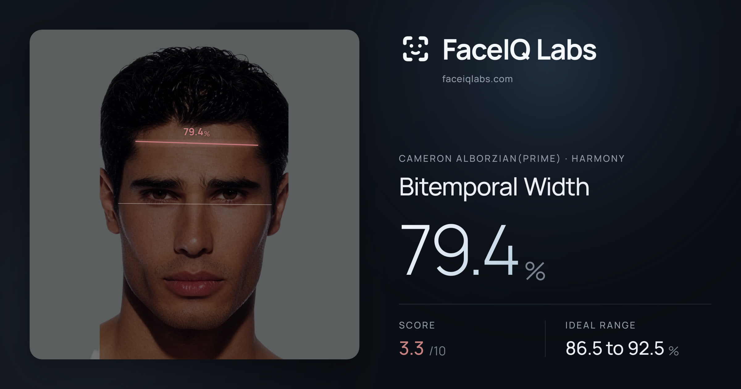 Cameron Alborzian(Prime) Bitemporal Width: 79.4%, drawn on the photo