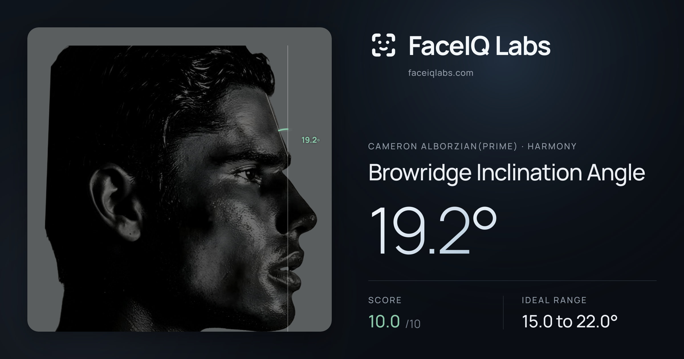 Cameron Alborzian(Prime) Browridge Inclination Angle: 19.2°, drawn on the photo