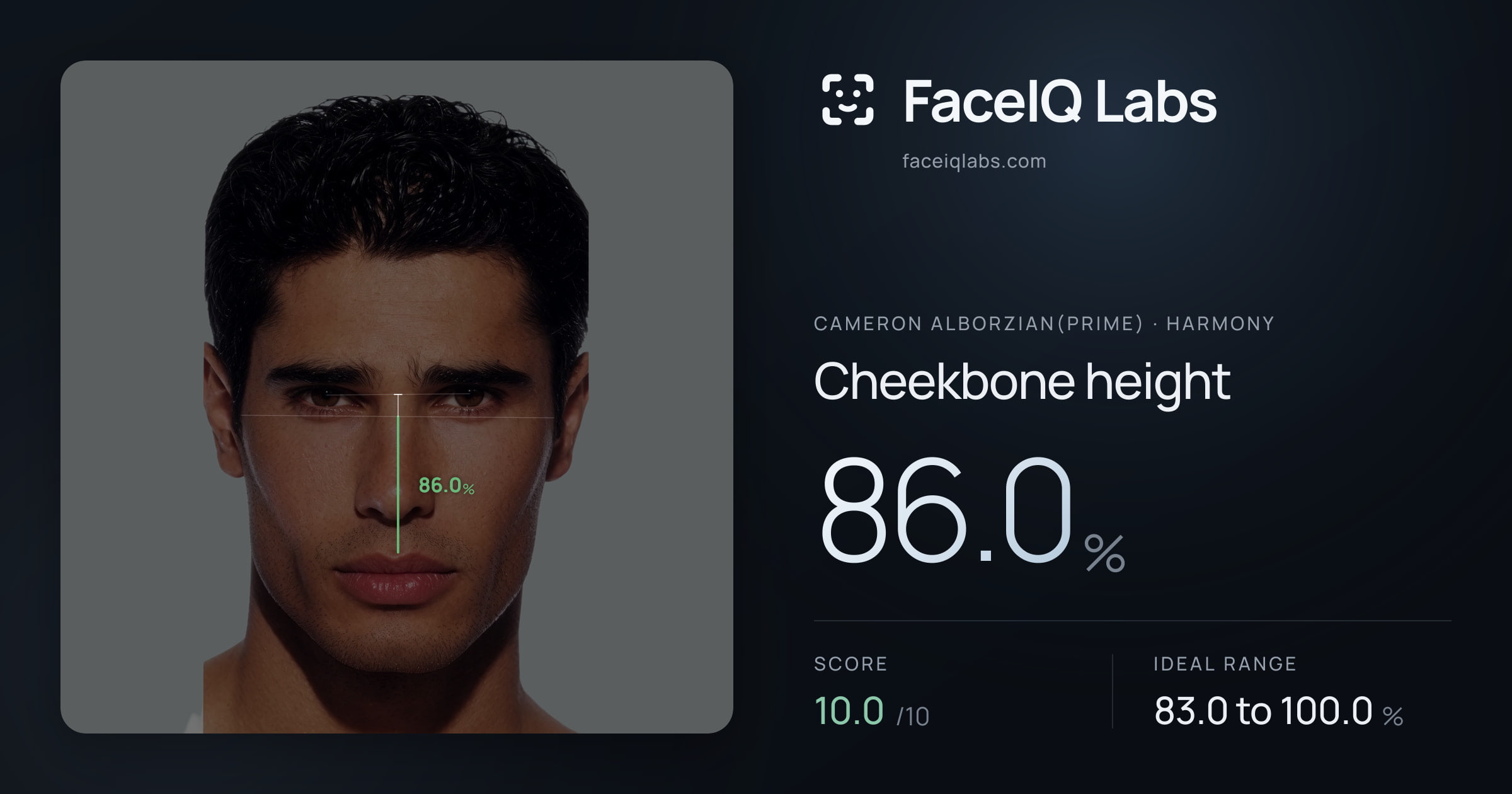 Cameron Alborzian(Prime) Cheekbone height: 86.0%, drawn on the photo