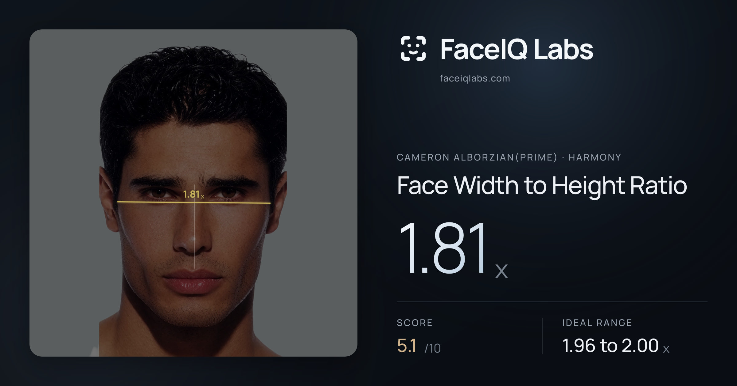 Cameron Alborzian(Prime) Face Width to Height Ratio: 1.81x, drawn on the photo