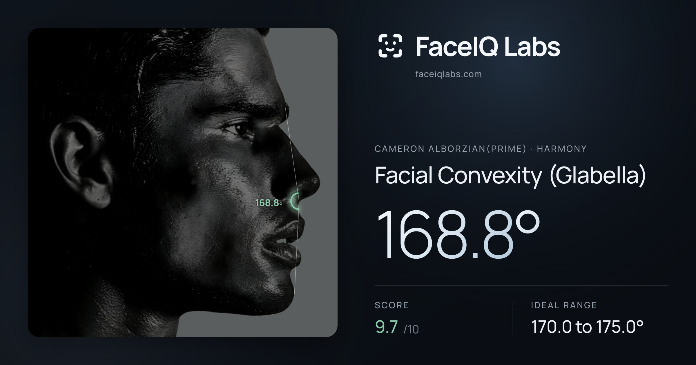 Cameron Alborzian(Prime) Facial Convexity (Glabella): 168.8°, drawn on the photo
