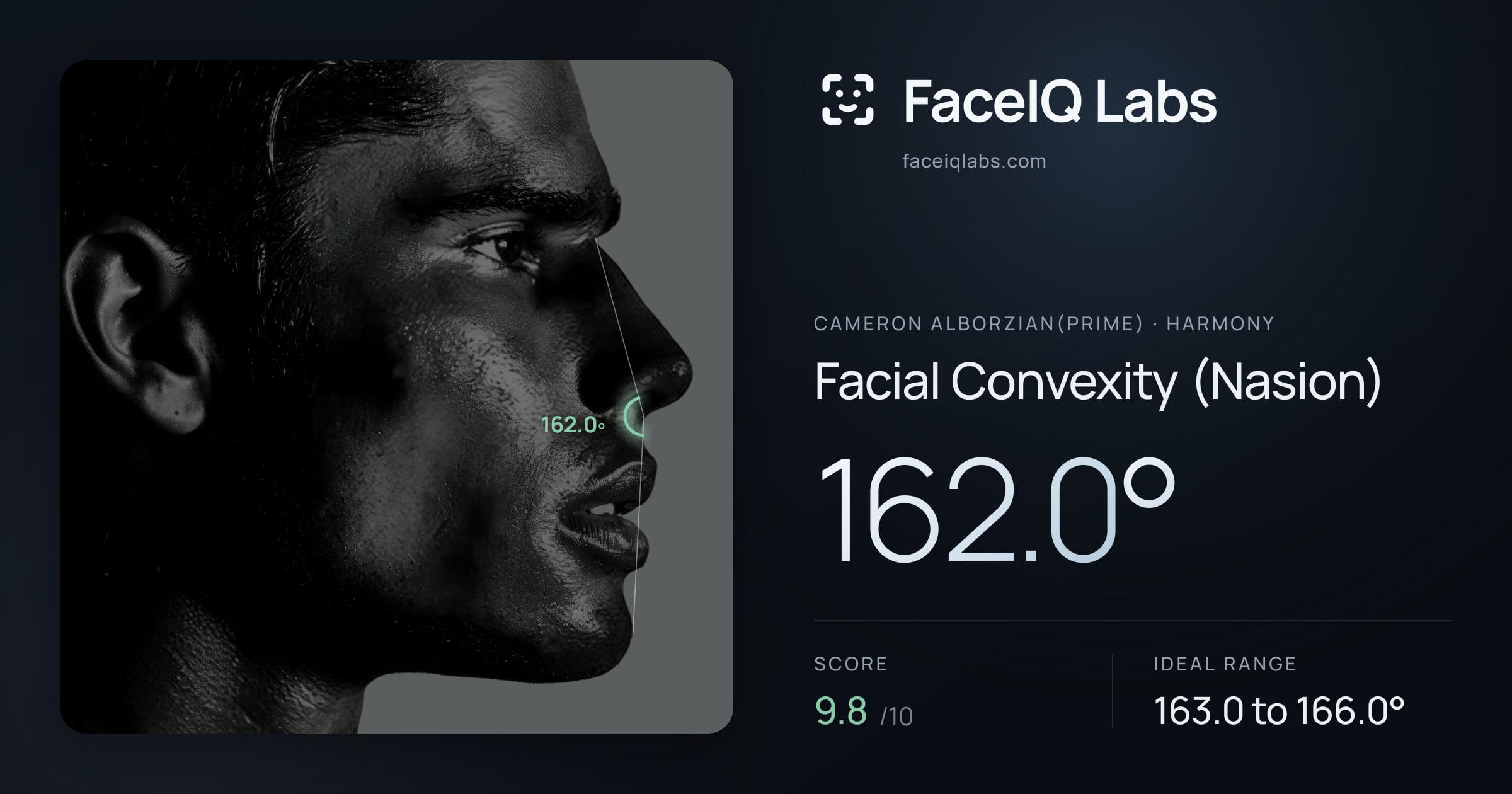 Cameron Alborzian(Prime) Facial Convexity (Nasion): 162.0°, drawn on the photo