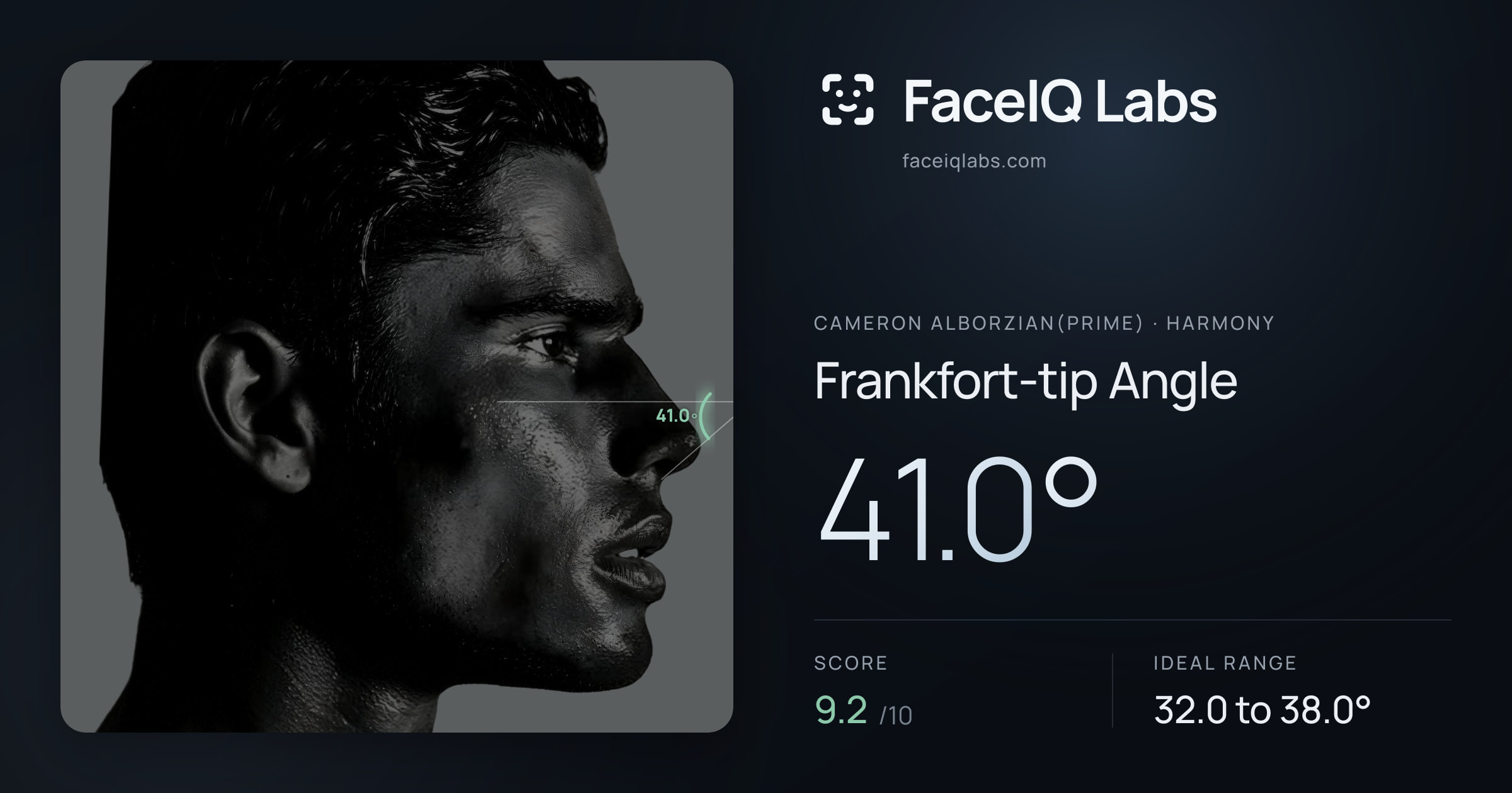 Cameron Alborzian(Prime) Frankfort-tip Angle: 41.0°, drawn on the photo
