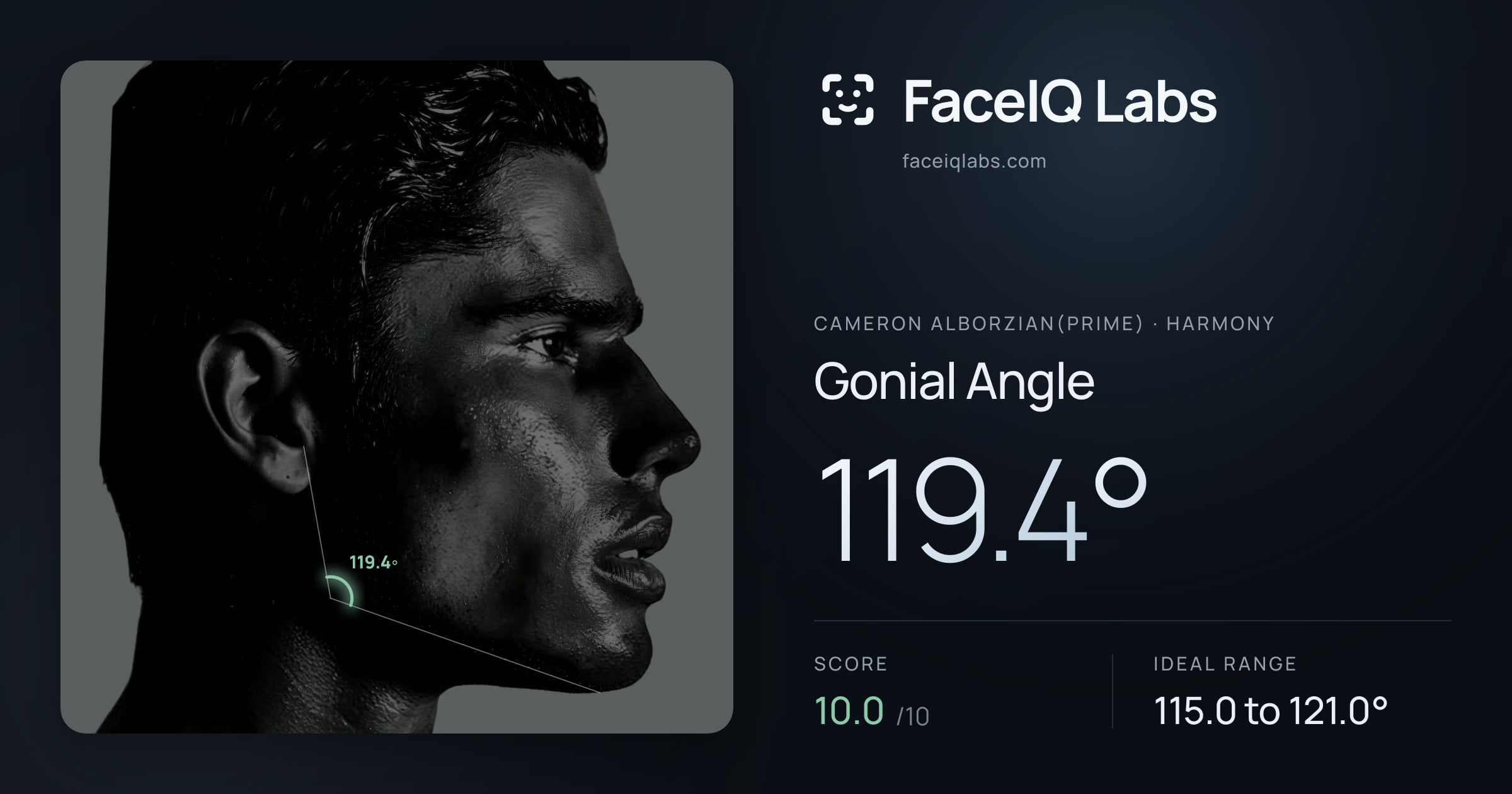 Cameron Alborzian(Prime) Gonial Angle: 119.4°, drawn on the photo