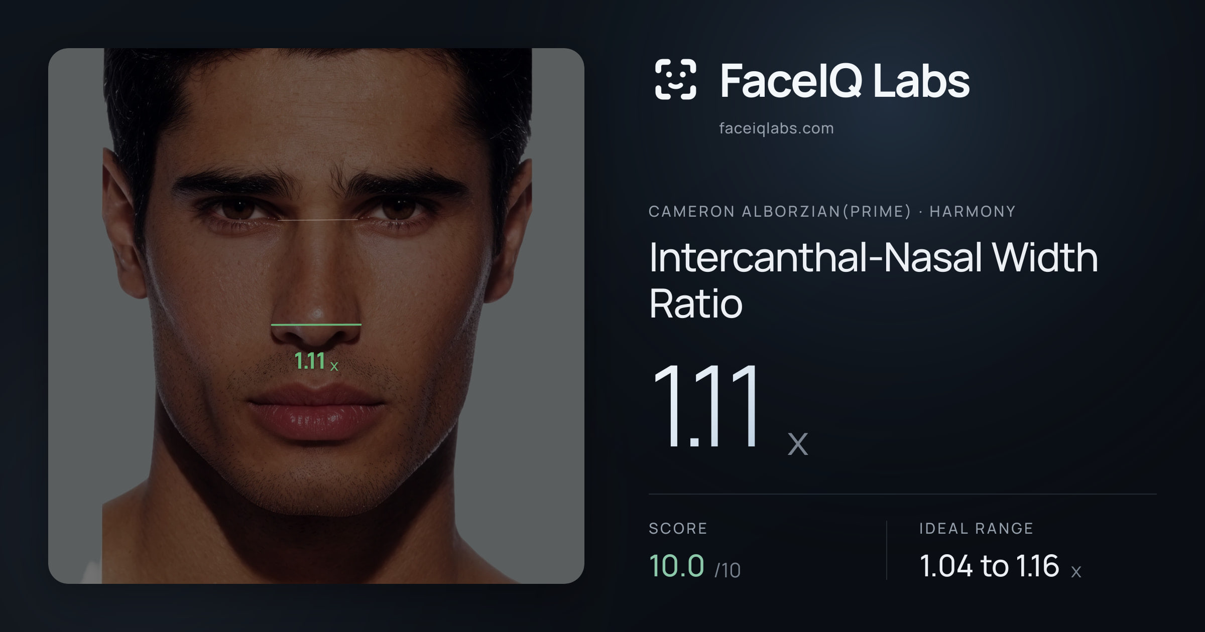 Cameron Alborzian(Prime) Intercanthal-Nasal Width Ratio: 1.11x, drawn on the photo