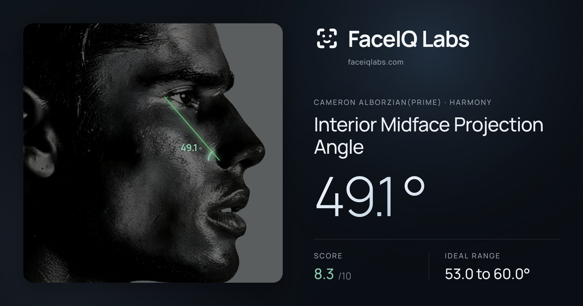 Cameron Alborzian(Prime) Interior Midface Projection Angle: 49.1°, drawn on the photo
