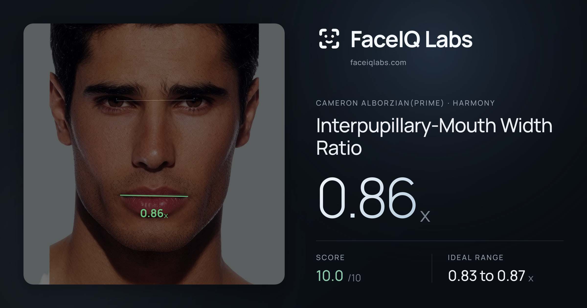 Cameron Alborzian(Prime) Interpupillary-Mouth Width Ratio: 0.86x, drawn on the photo