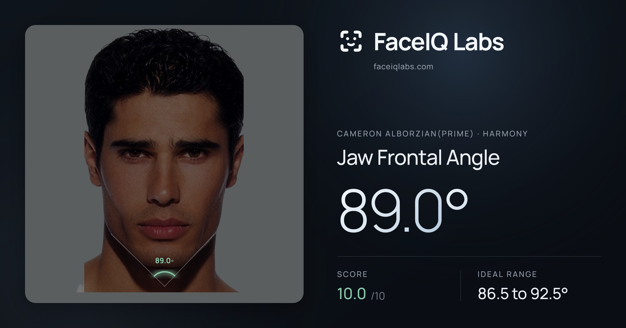 Cameron Alborzian(Prime) Jaw Frontal Angle: 89.0°, drawn on the photo
