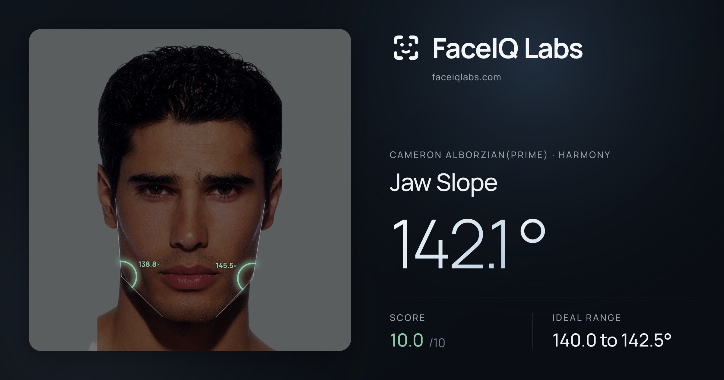 Cameron Alborzian(Prime) Jaw Slope: 142.1°, drawn on the photo