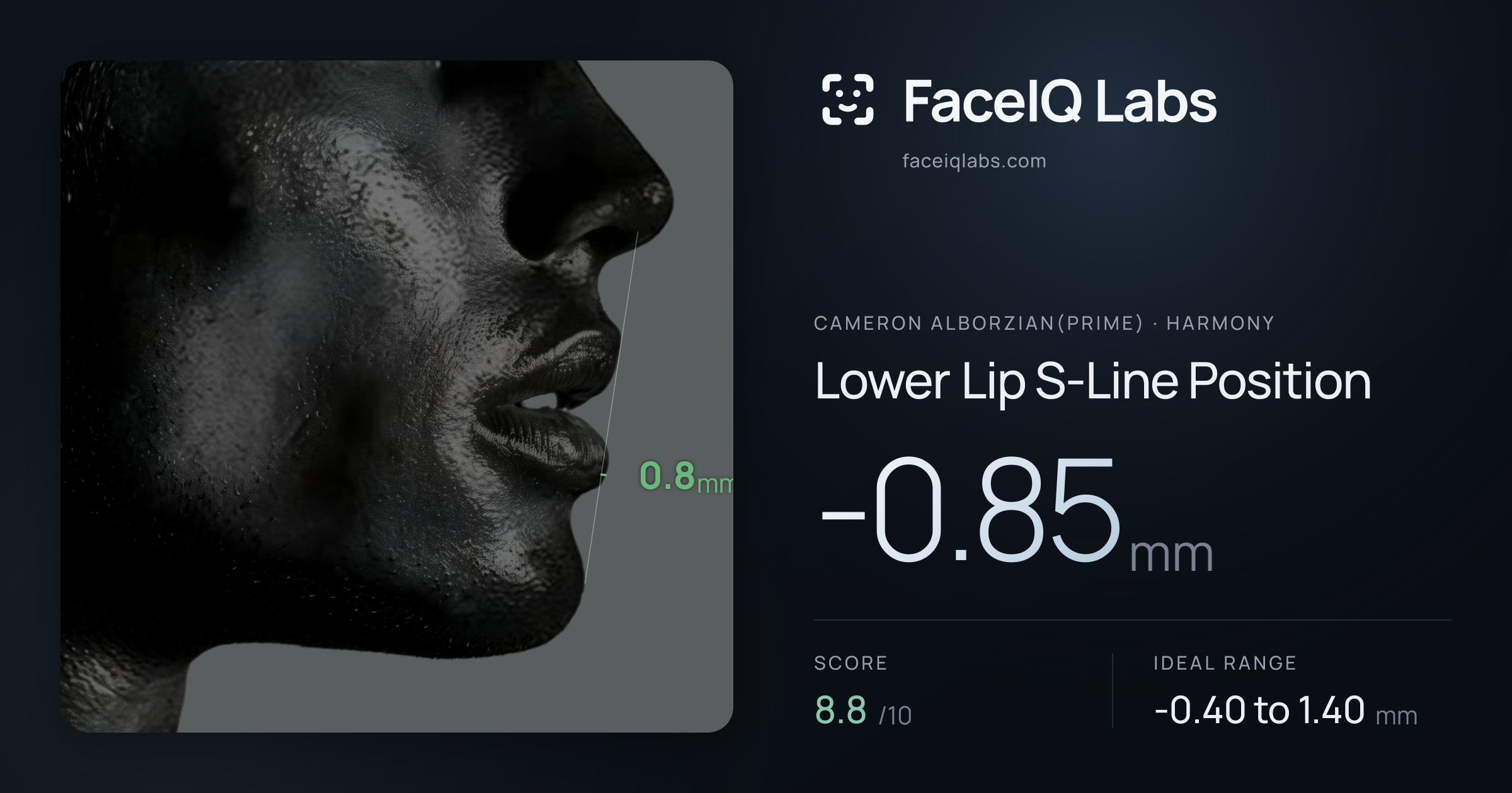Cameron Alborzian(Prime) Lower Lip S-Line Position: -0.85mm, drawn on the photo
