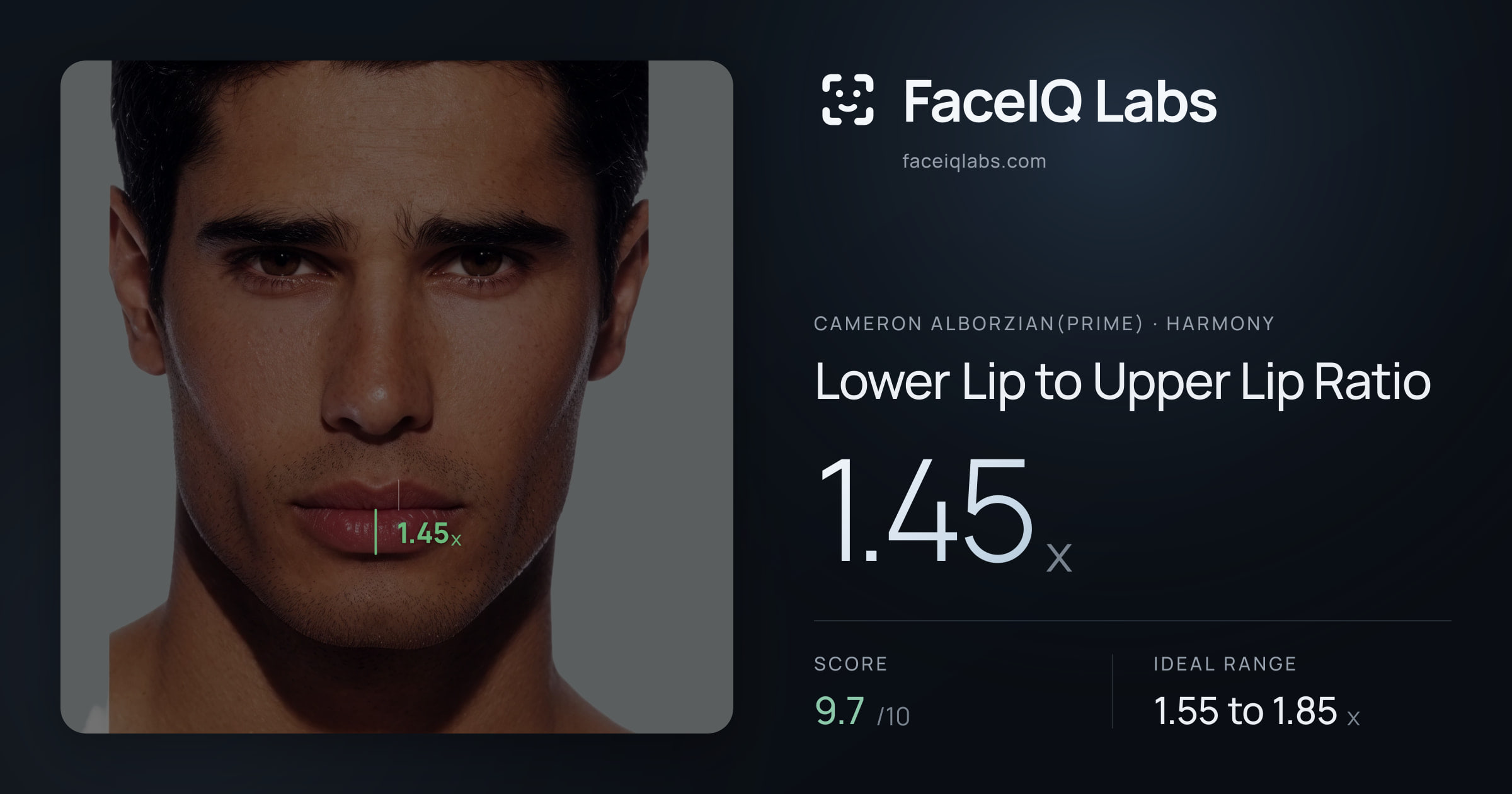 Cameron Alborzian(Prime) Lower Lip to Upper Lip Ratio: 1.45x, drawn on the photo