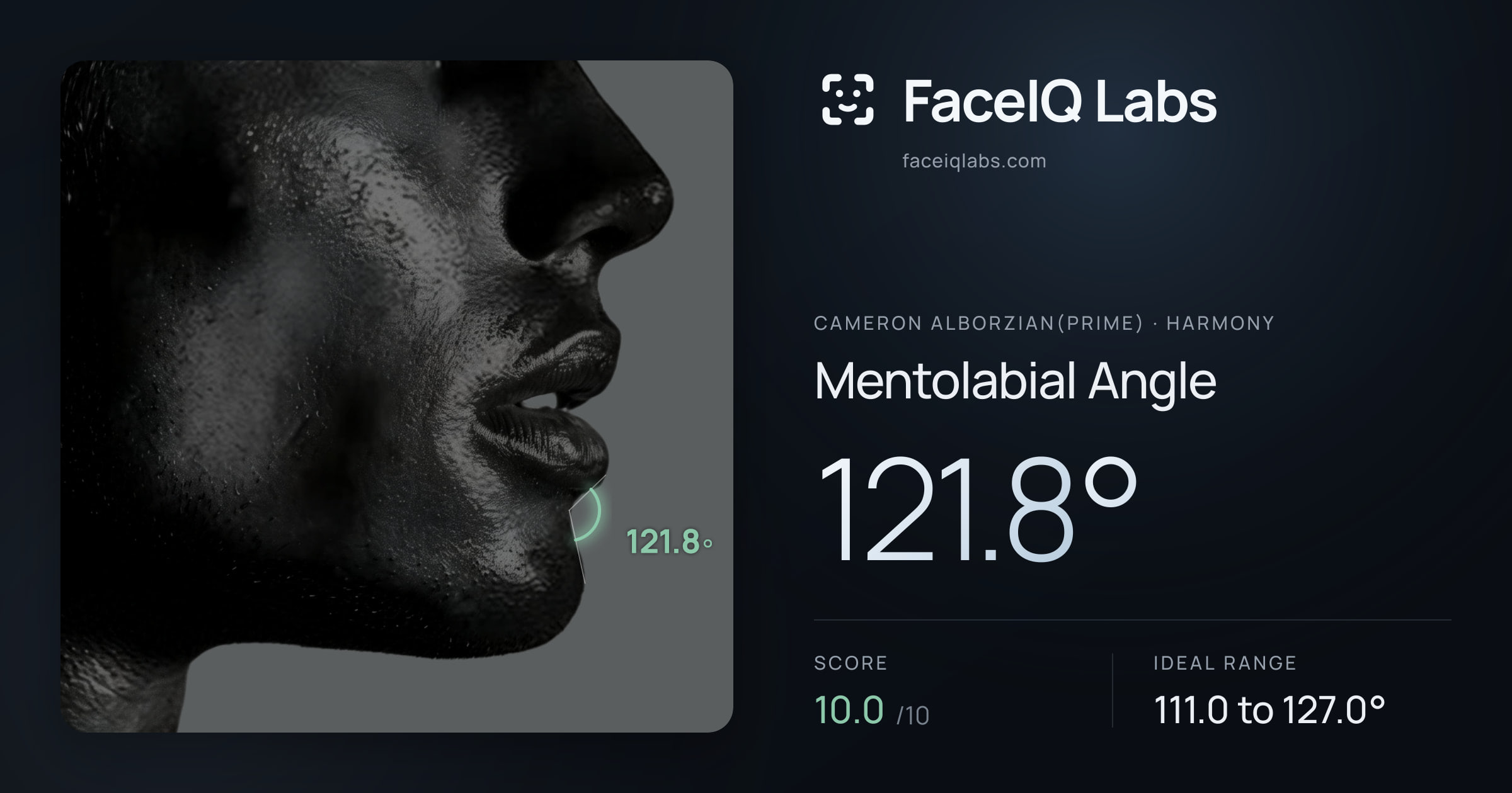 Cameron Alborzian(Prime) Mentolabial Angle: 121.8°, drawn on the photo