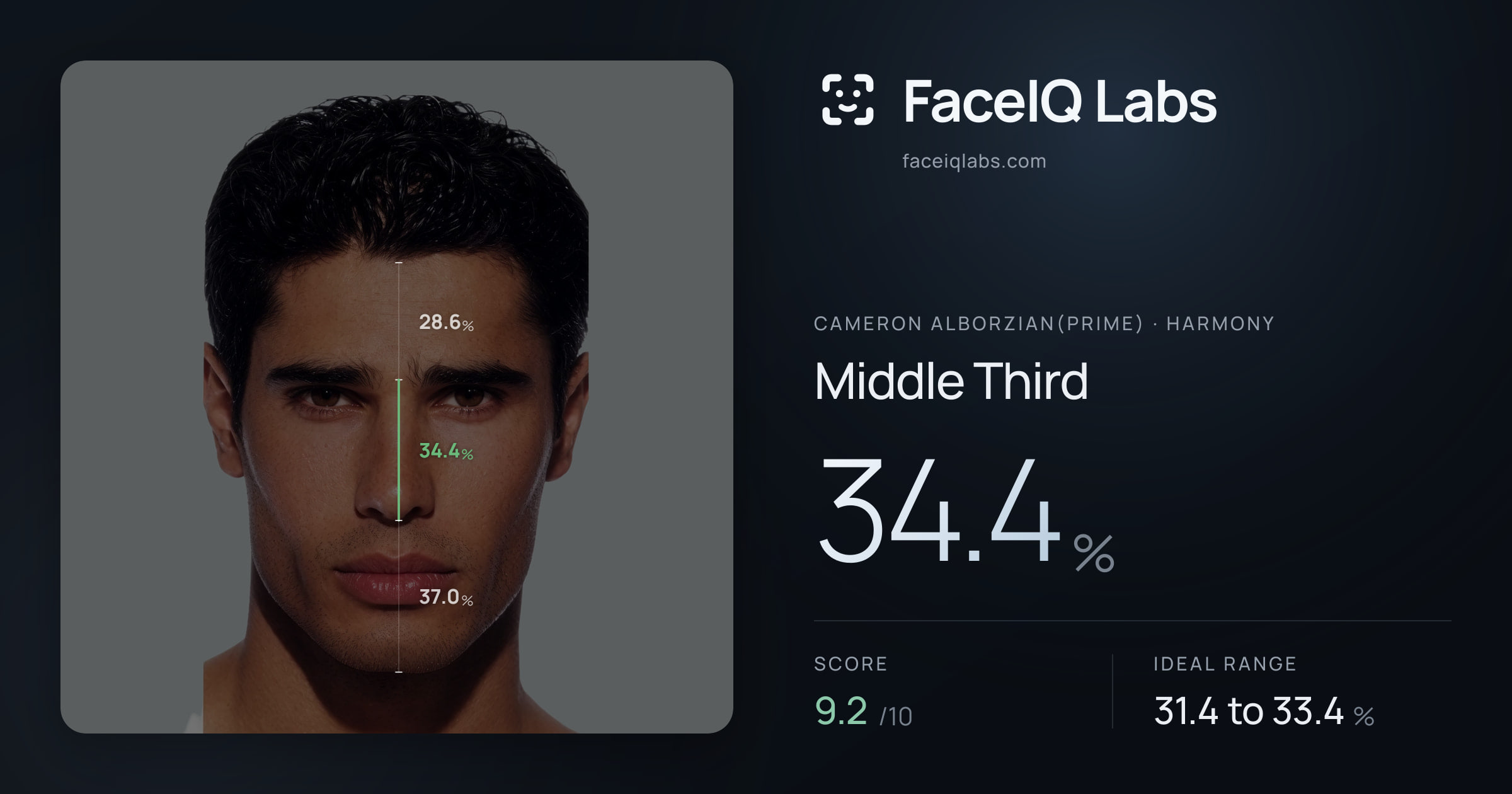 Cameron Alborzian(Prime) Middle Third: 34.4%, drawn on the photo