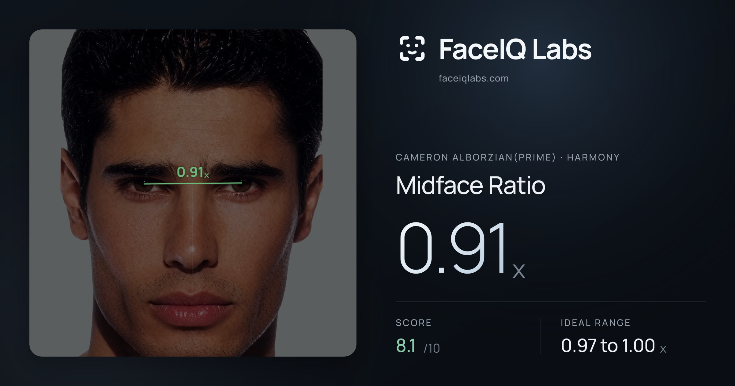 Cameron Alborzian(Prime) Midface Ratio: 0.91x, drawn on the photo