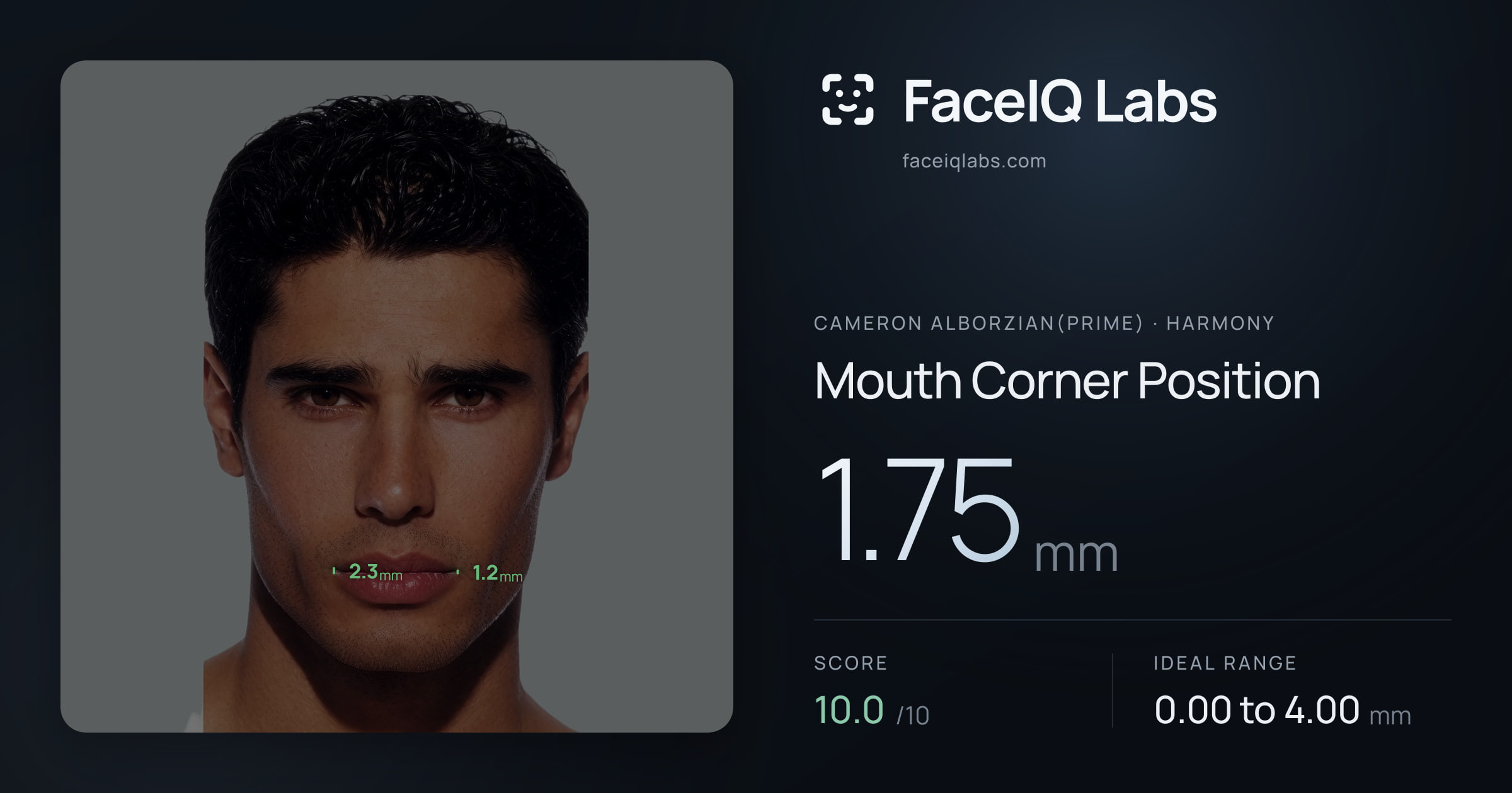 Cameron Alborzian(Prime) Mouth Corner Position: 1.75mm, drawn on the photo