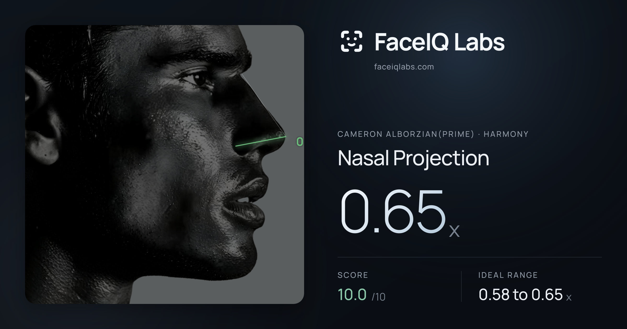 Cameron Alborzian(Prime) Nasal Projection: 0.65x, drawn on the photo