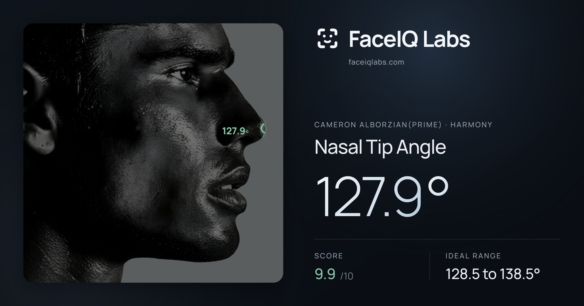 Cameron Alborzian(Prime) Nasal Tip Angle: 127.9°, drawn on the photo
