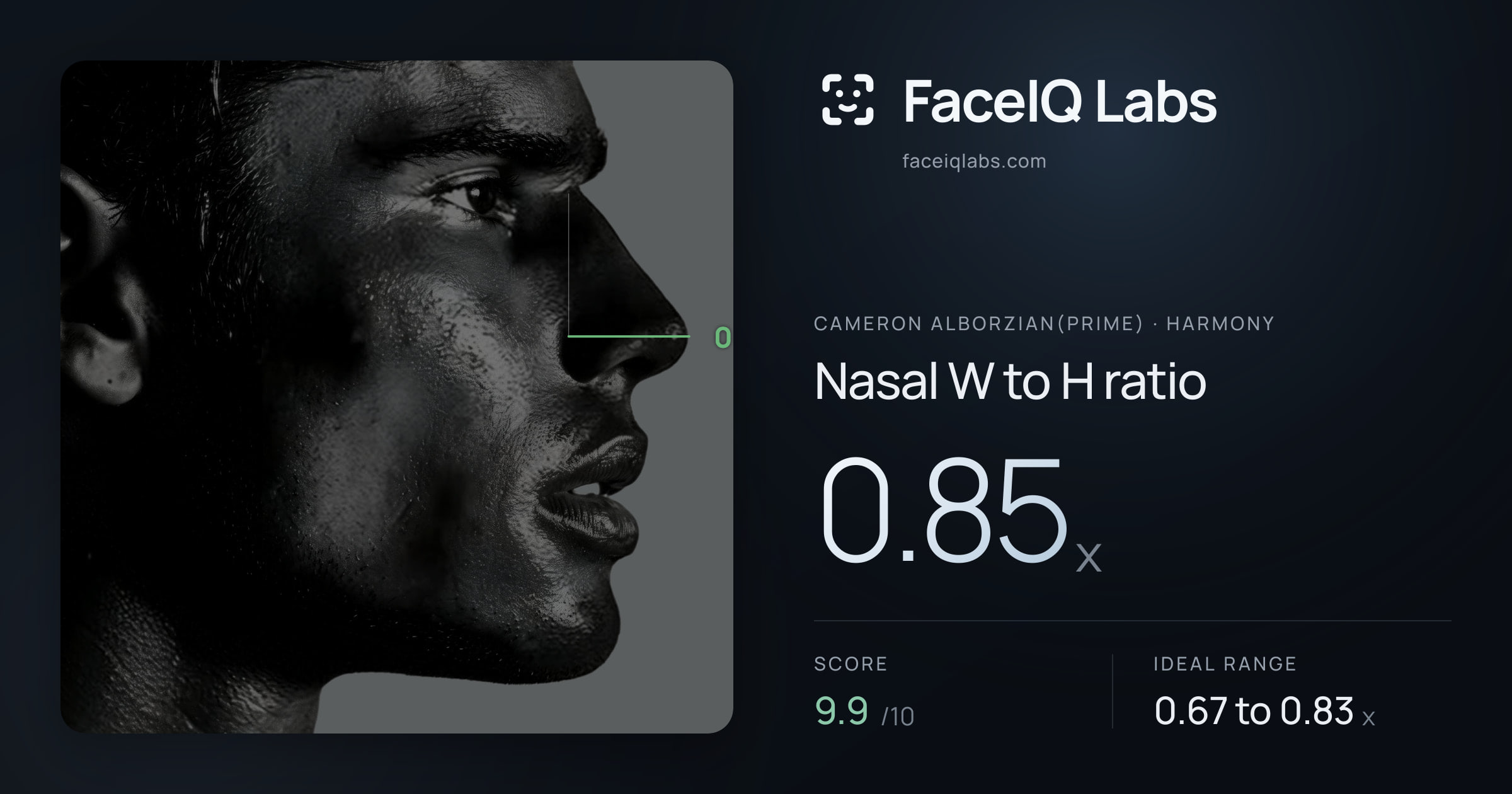 Cameron Alborzian(Prime) Nasal W to H ratio: 0.85x, drawn on the photo